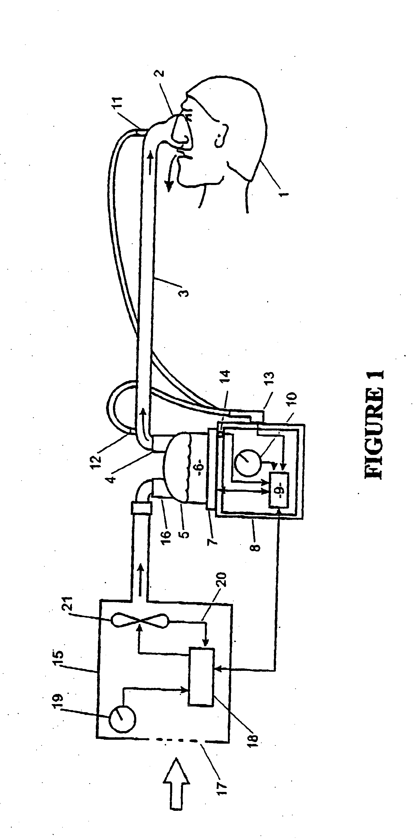 Patient interfaces