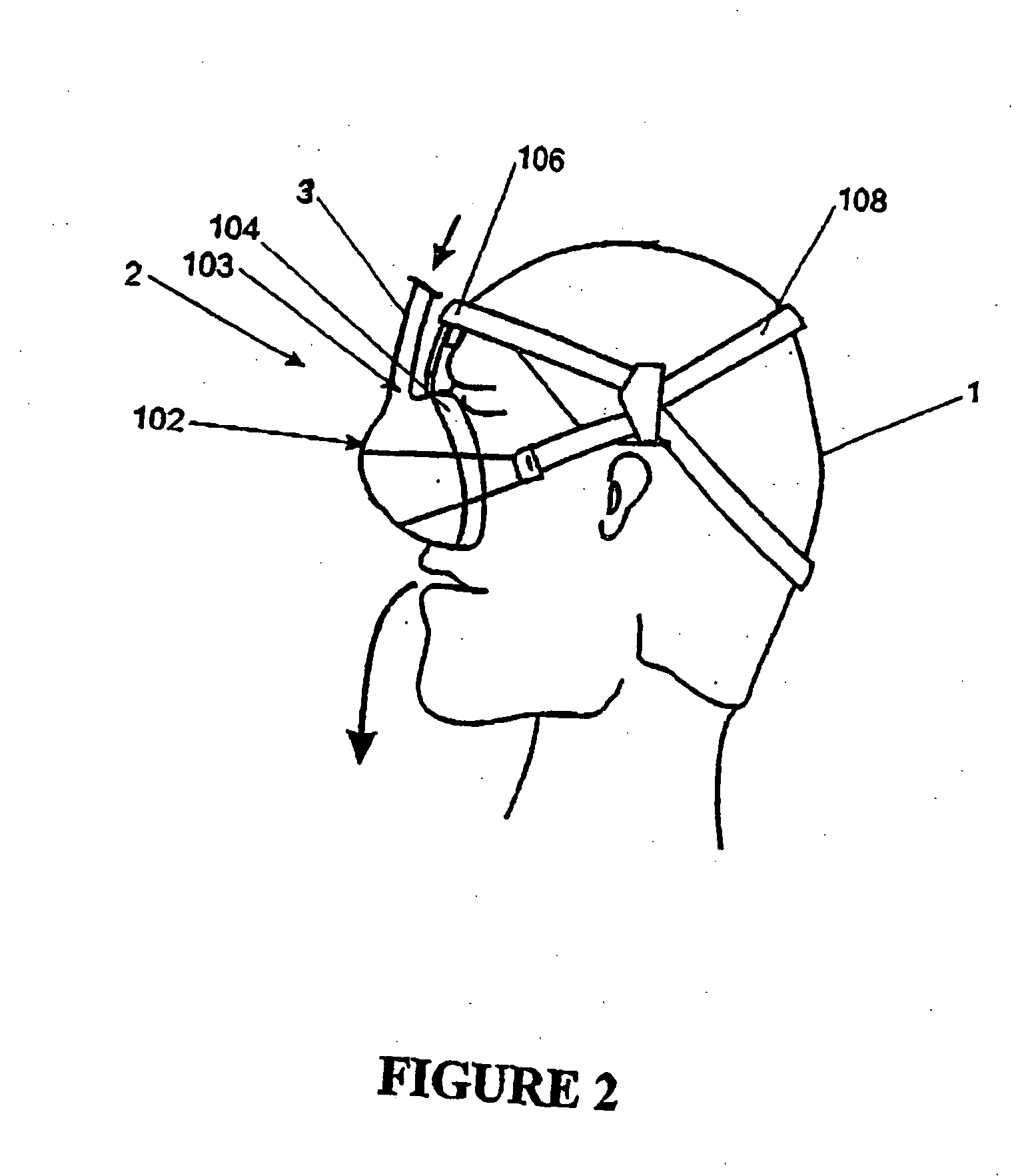 Patient interfaces