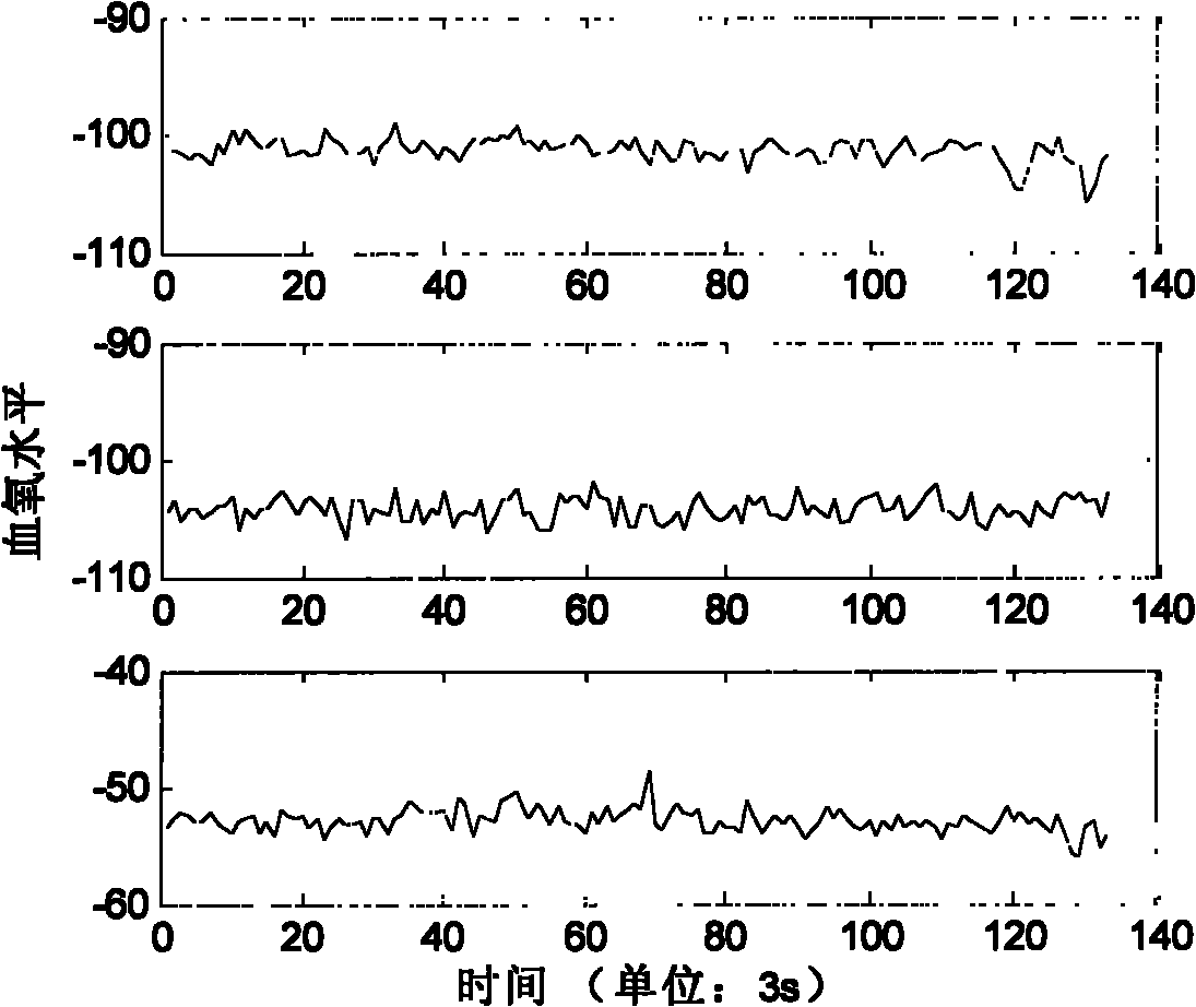 Method for recognizing function response signal under function nuclear magnetic resonance scan