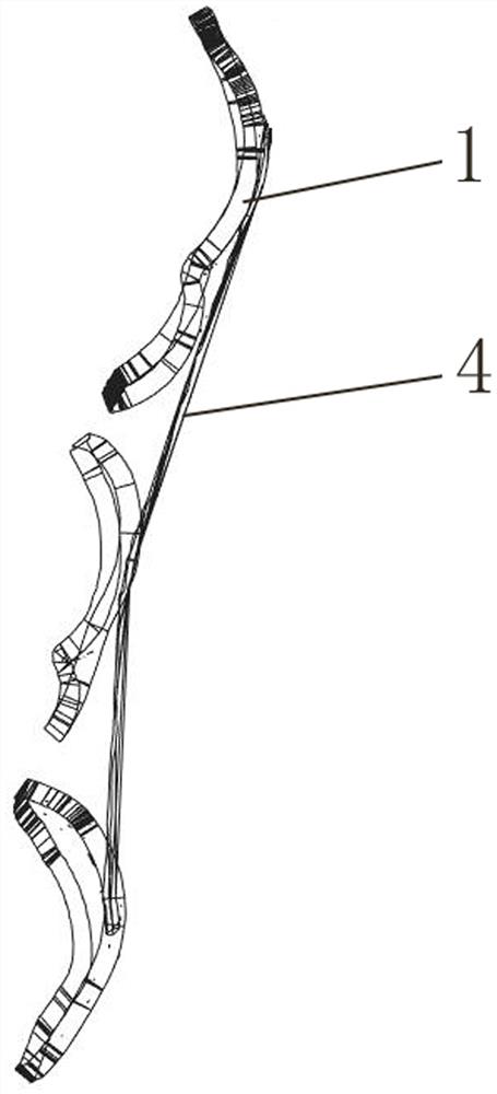 Preparation method of lingual orthodontic device for tooth correction