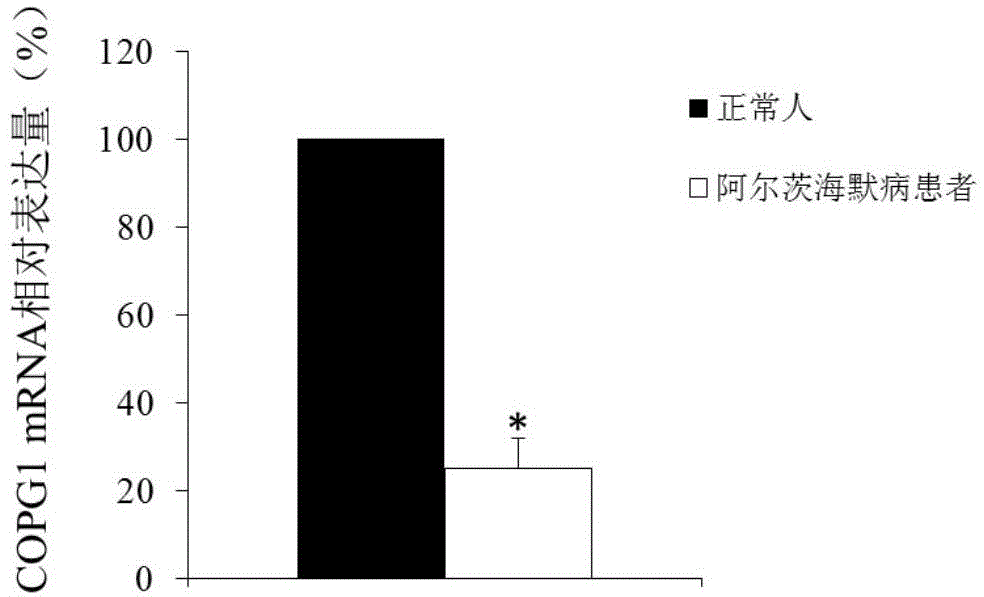 Alzheimer disease diagnosis and treatment marker and application thereof