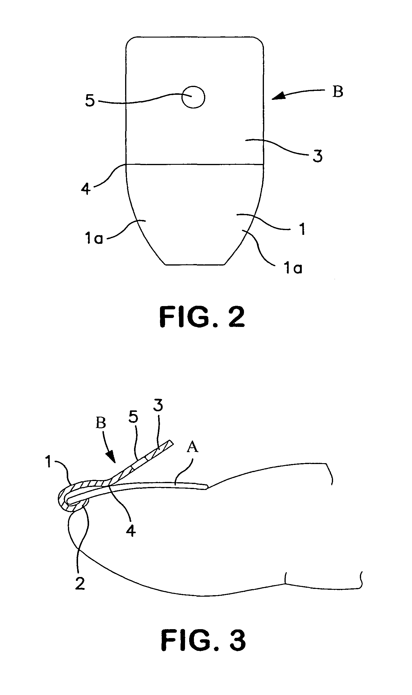 Ingrown nail correcting device