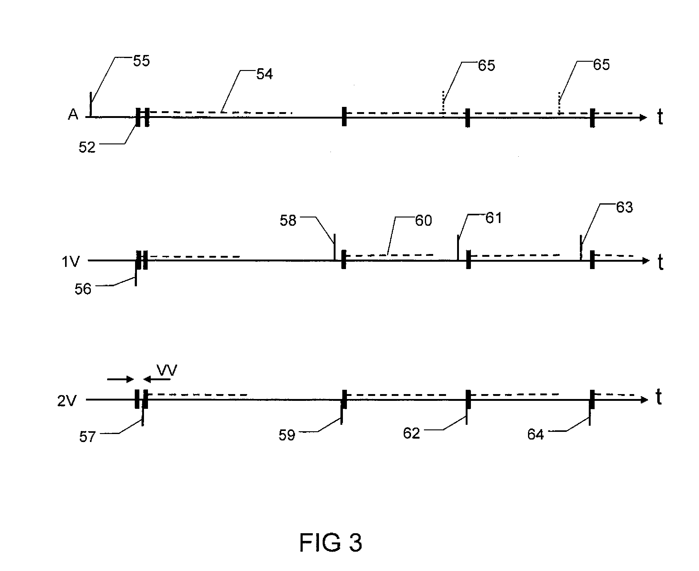 Implantable Heart Stimulation Device and Method