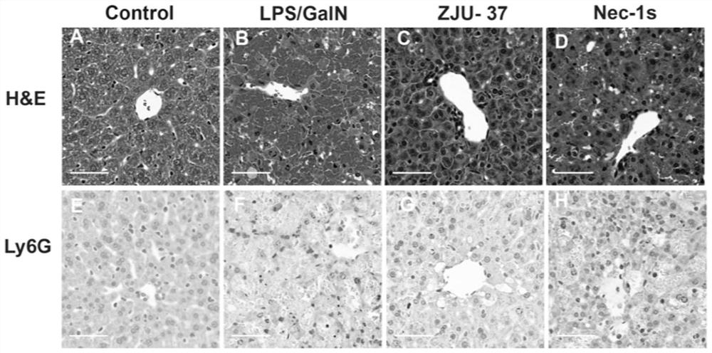 Application of compound ZJU-37 in preparation of medicines for preventing and/or treating liver diseases