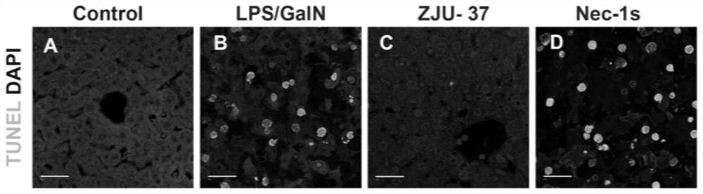 Application of compound ZJU-37 in preparation of medicines for preventing and/or treating liver diseases