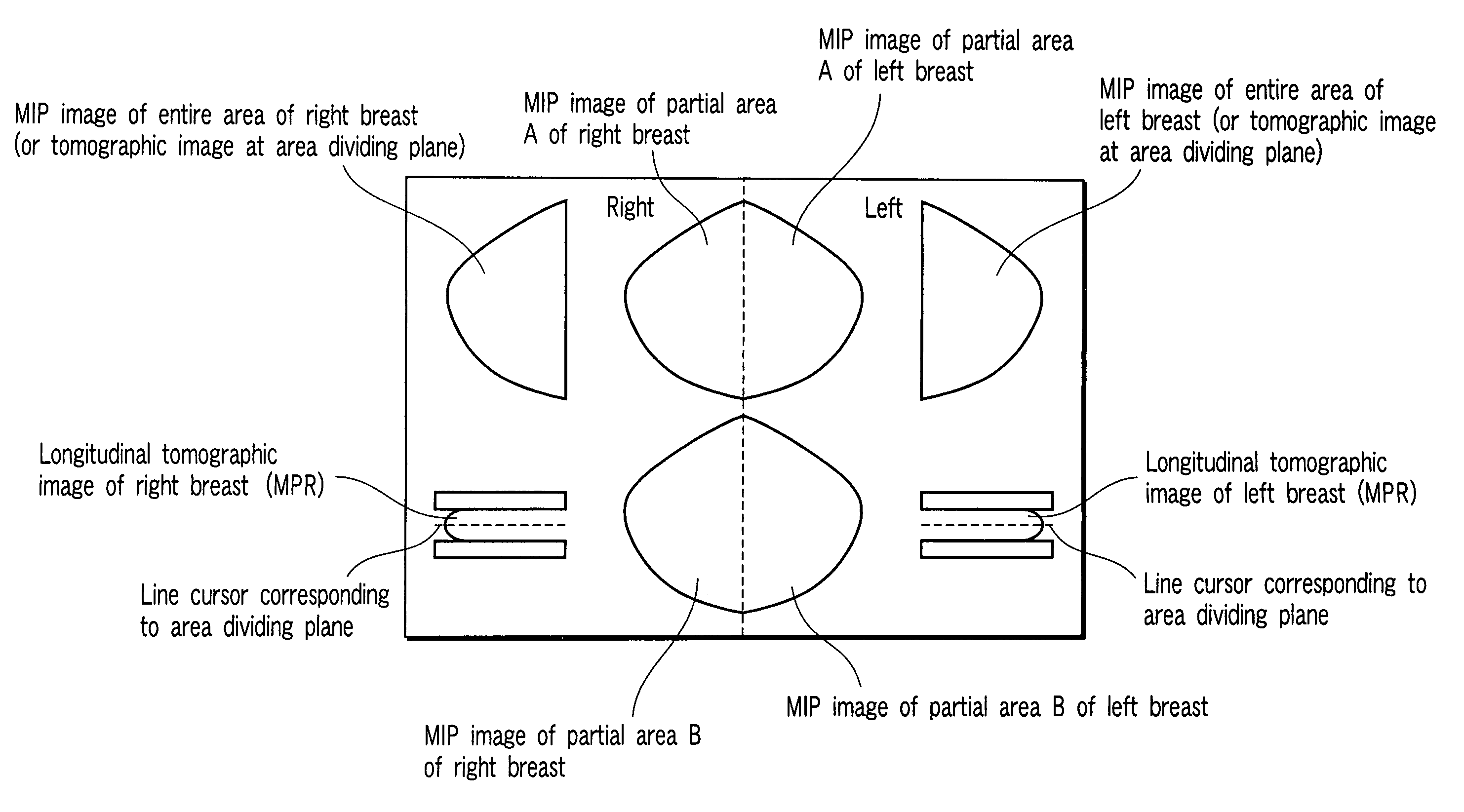 Image displaying apparatus, image displaying method, and computer readable medium for displaying an image of a mammary gland structure without overlaps thereof