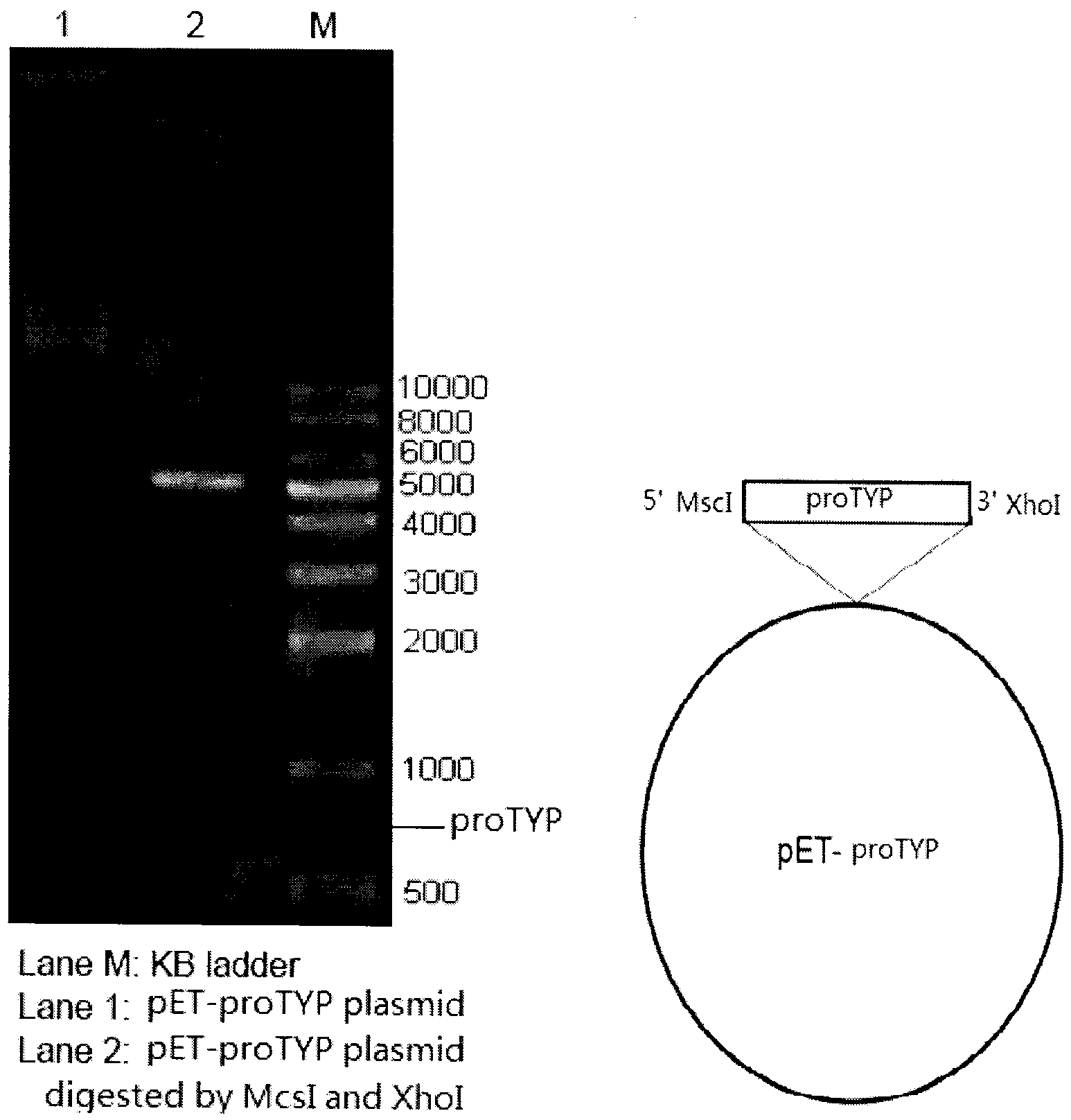 Preparation method of recombinant trypsin