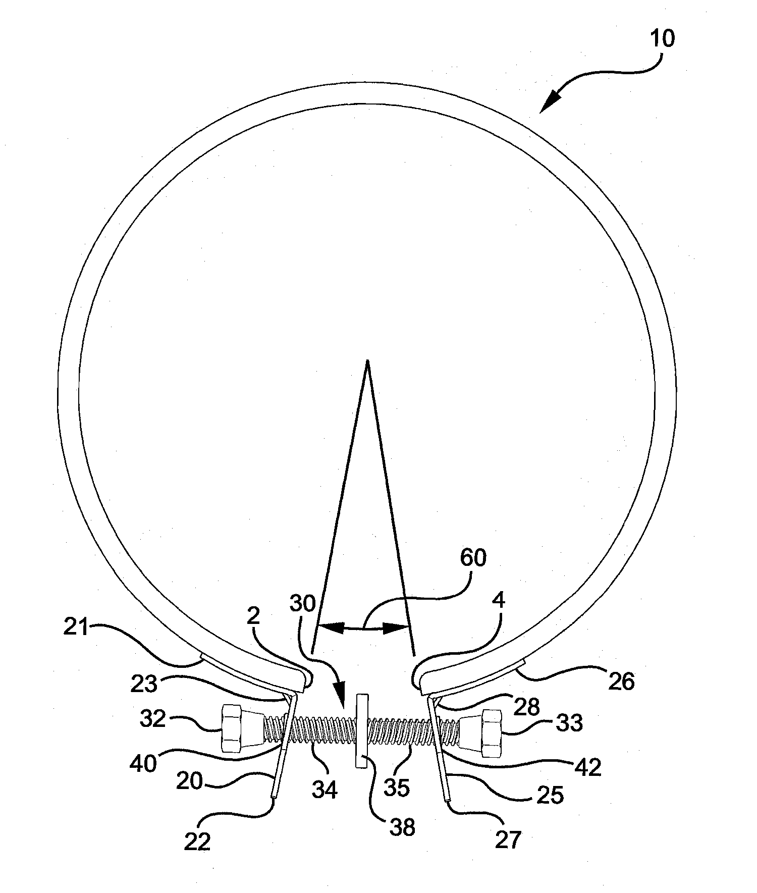 Sealing ring with improved fastener