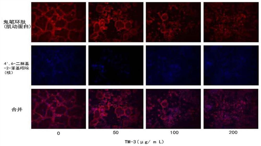 Composition for prevention and treatment of bone disease containing mixed Chinese herbal medicine extract