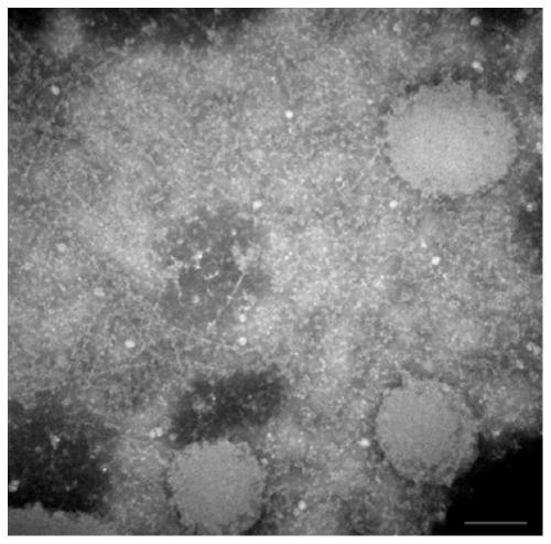 Dental pulp stem cell exosome preparation as well as preparation method and application thereof