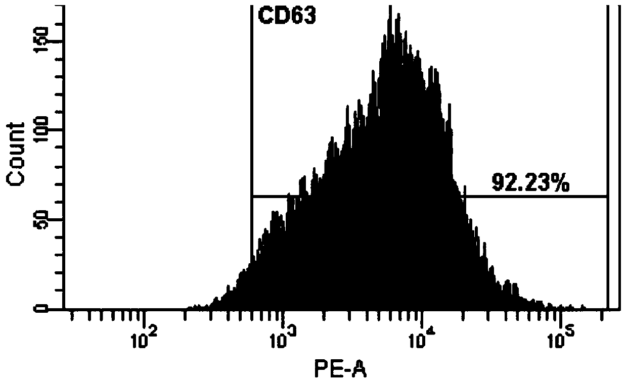 Dental pulp stem cell exosome preparation as well as preparation method and application thereof