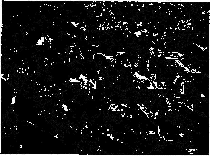 Bulleyaconitine A lipidosome freeze-dried powder injection and preparation method thereof