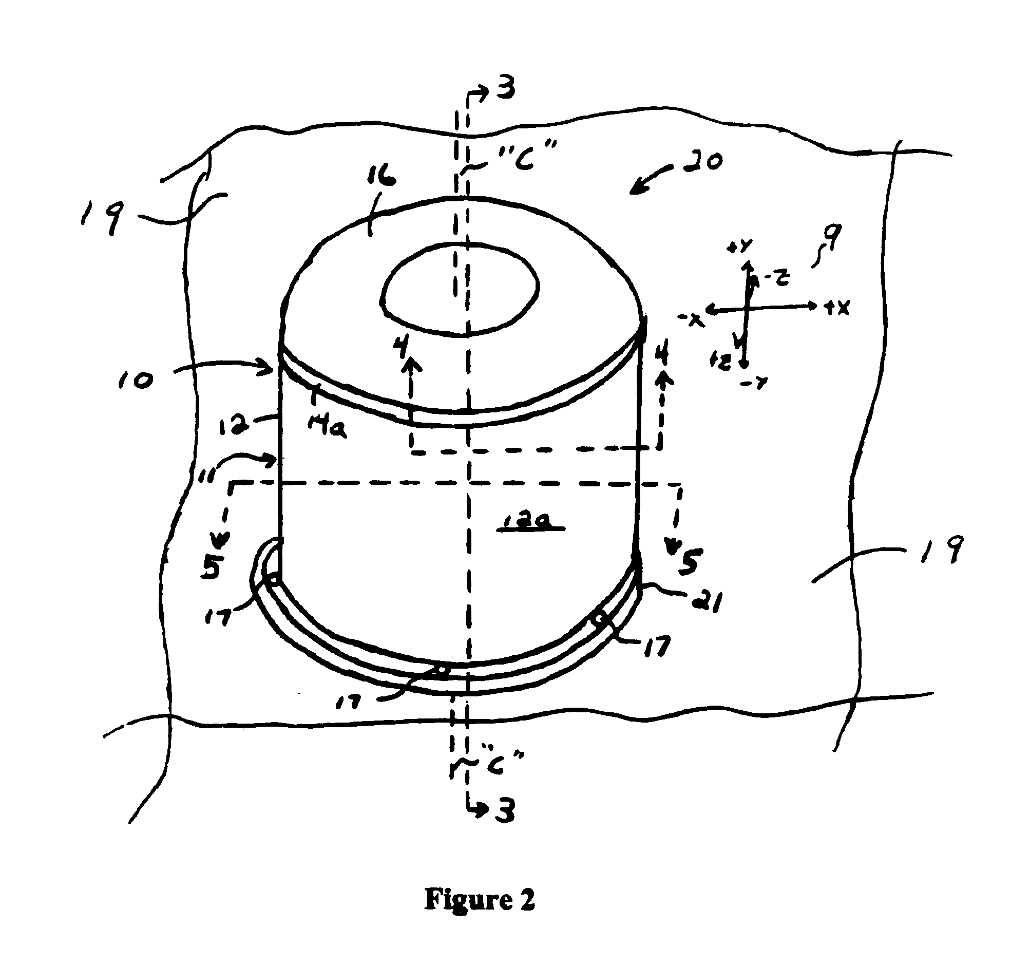 Energy-absorbing housing for high-speed flywheels