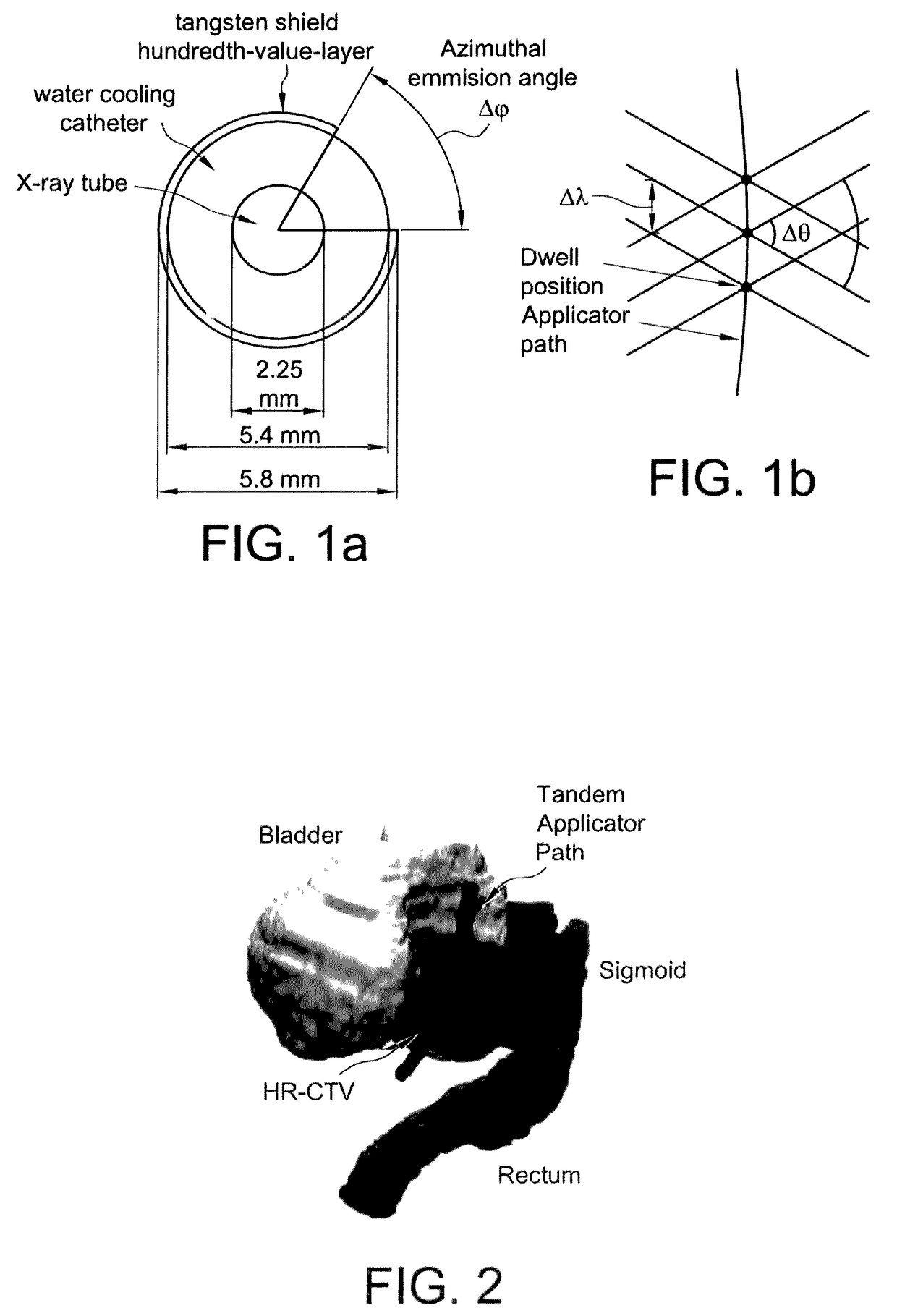 Advanced rotating-shield brachytherapy and planning of the same