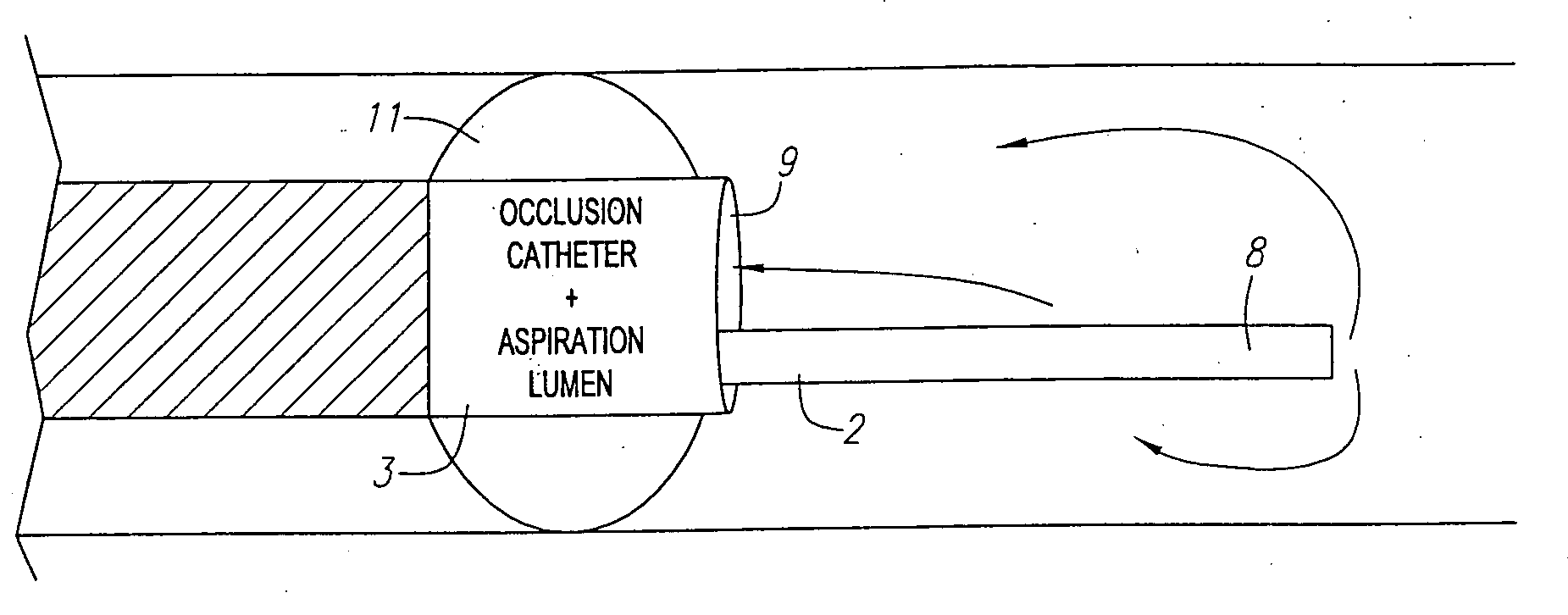 Fluid exchange system for controlled and localized irrigation and aspiration