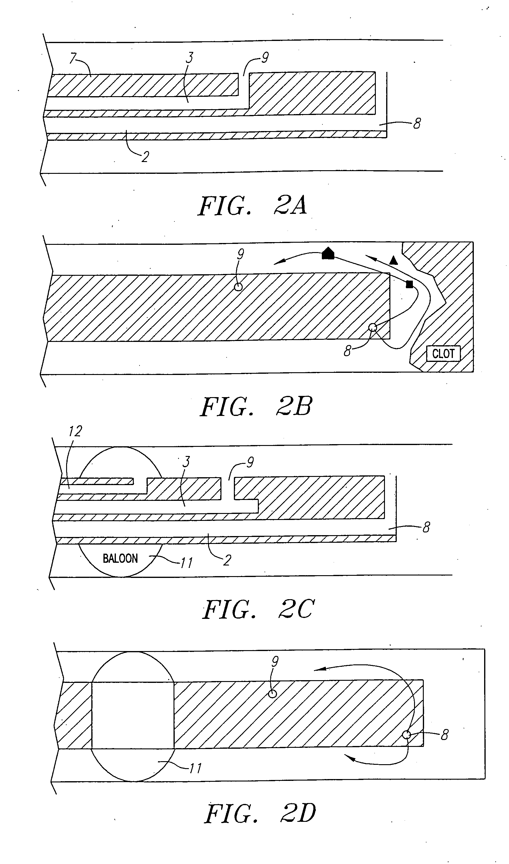 Fluid exchange system for controlled and localized irrigation and aspiration