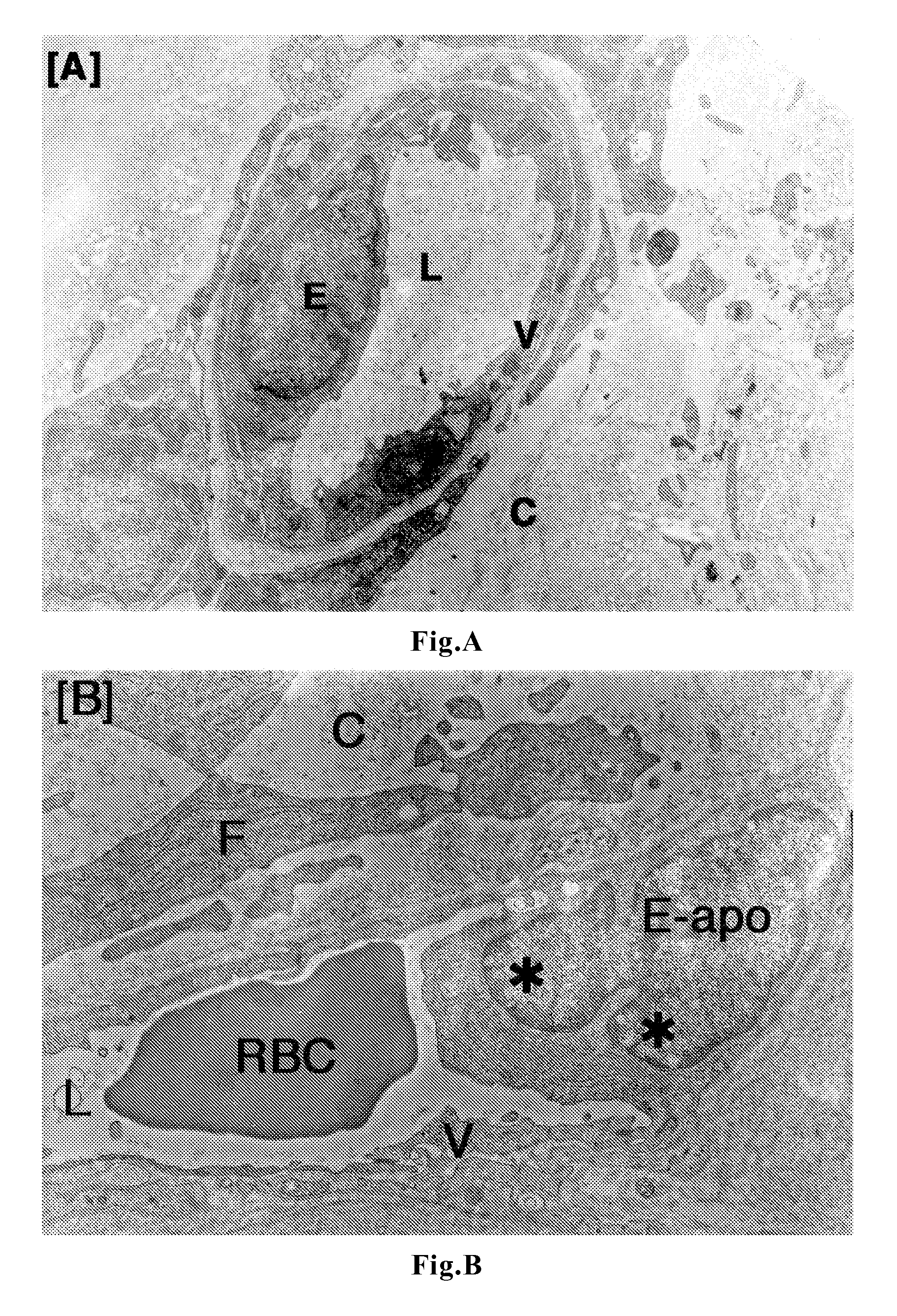 Antitumor agent