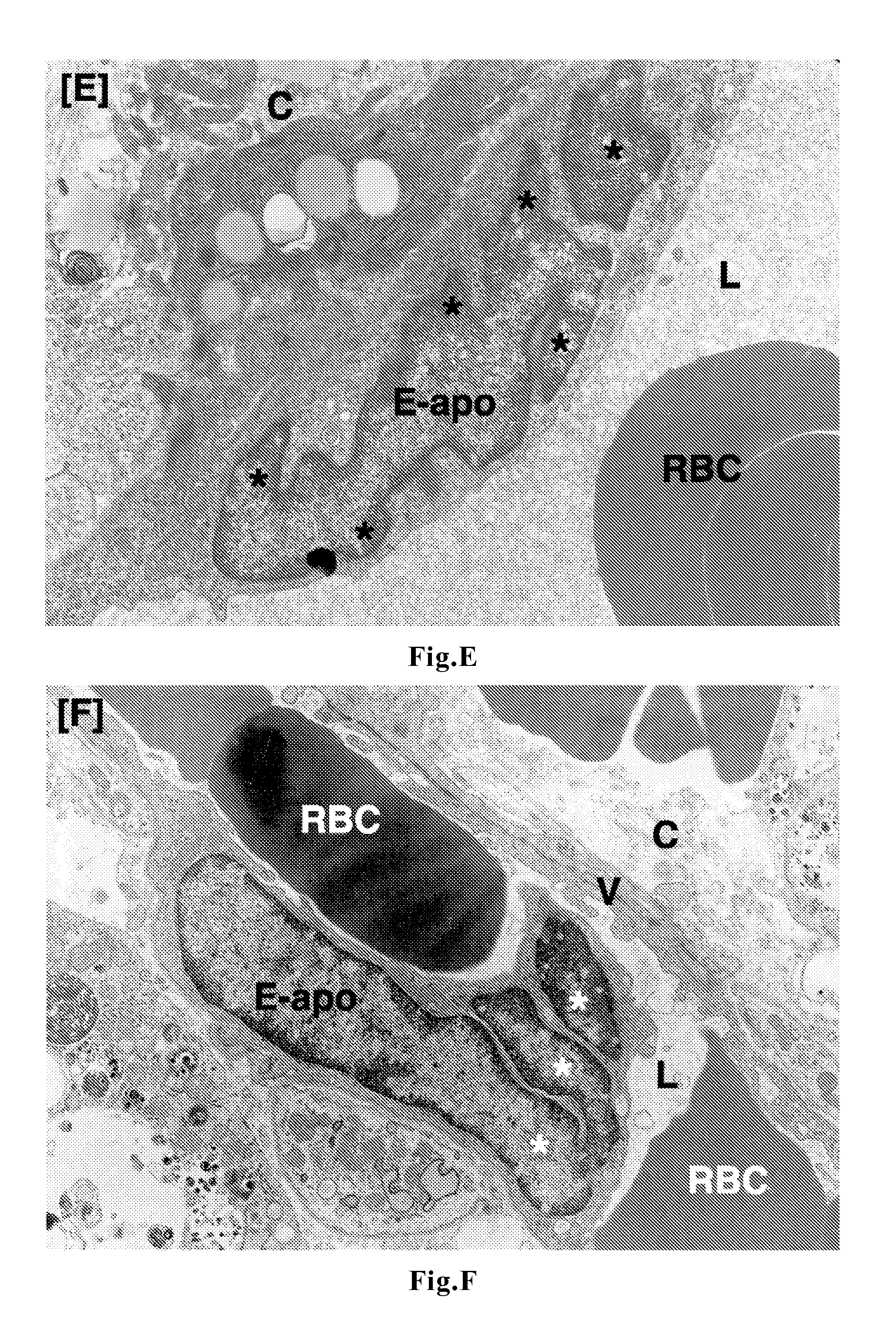 Antitumor agent