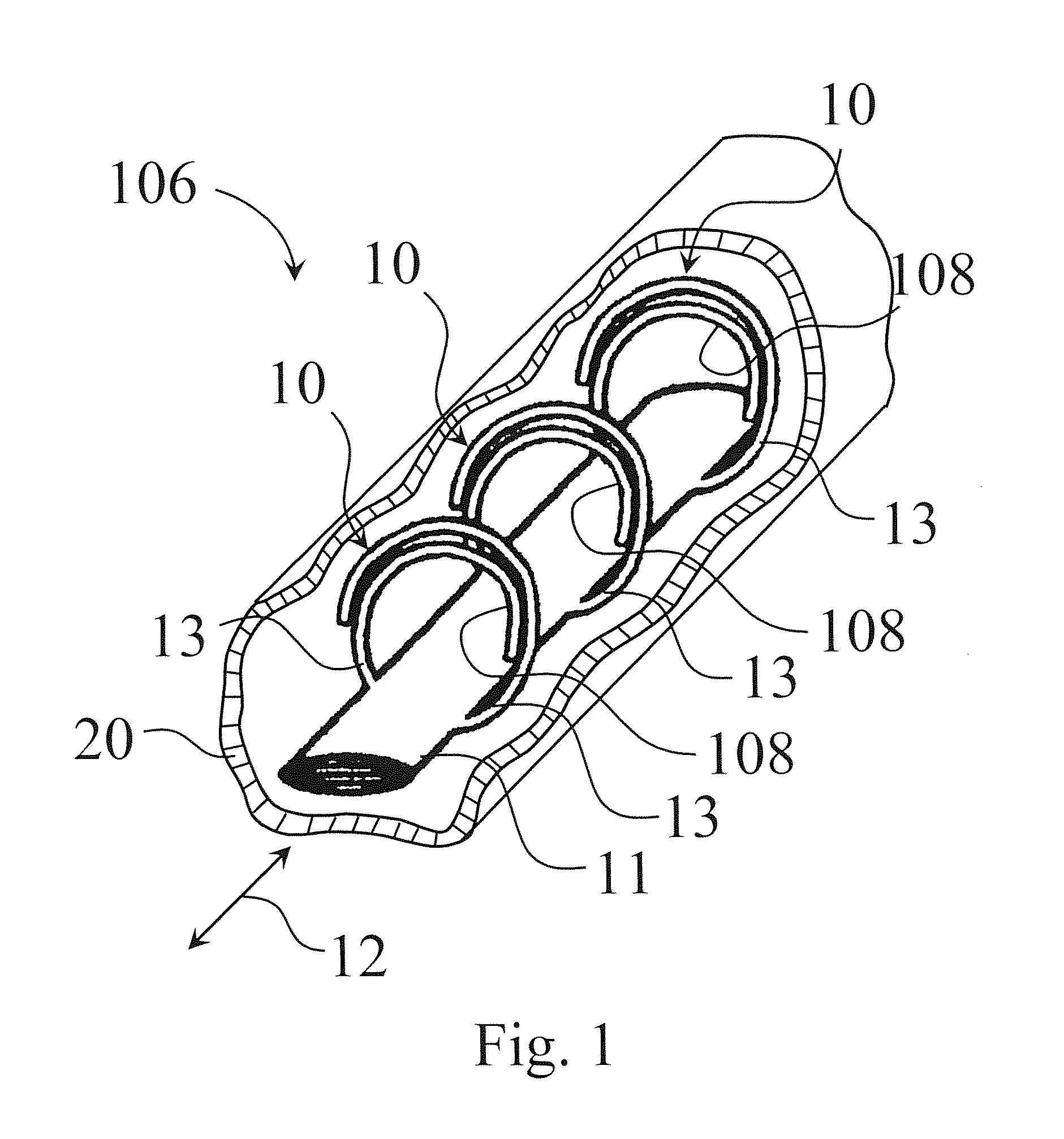 Endovascular electrode system for tissue stimulation