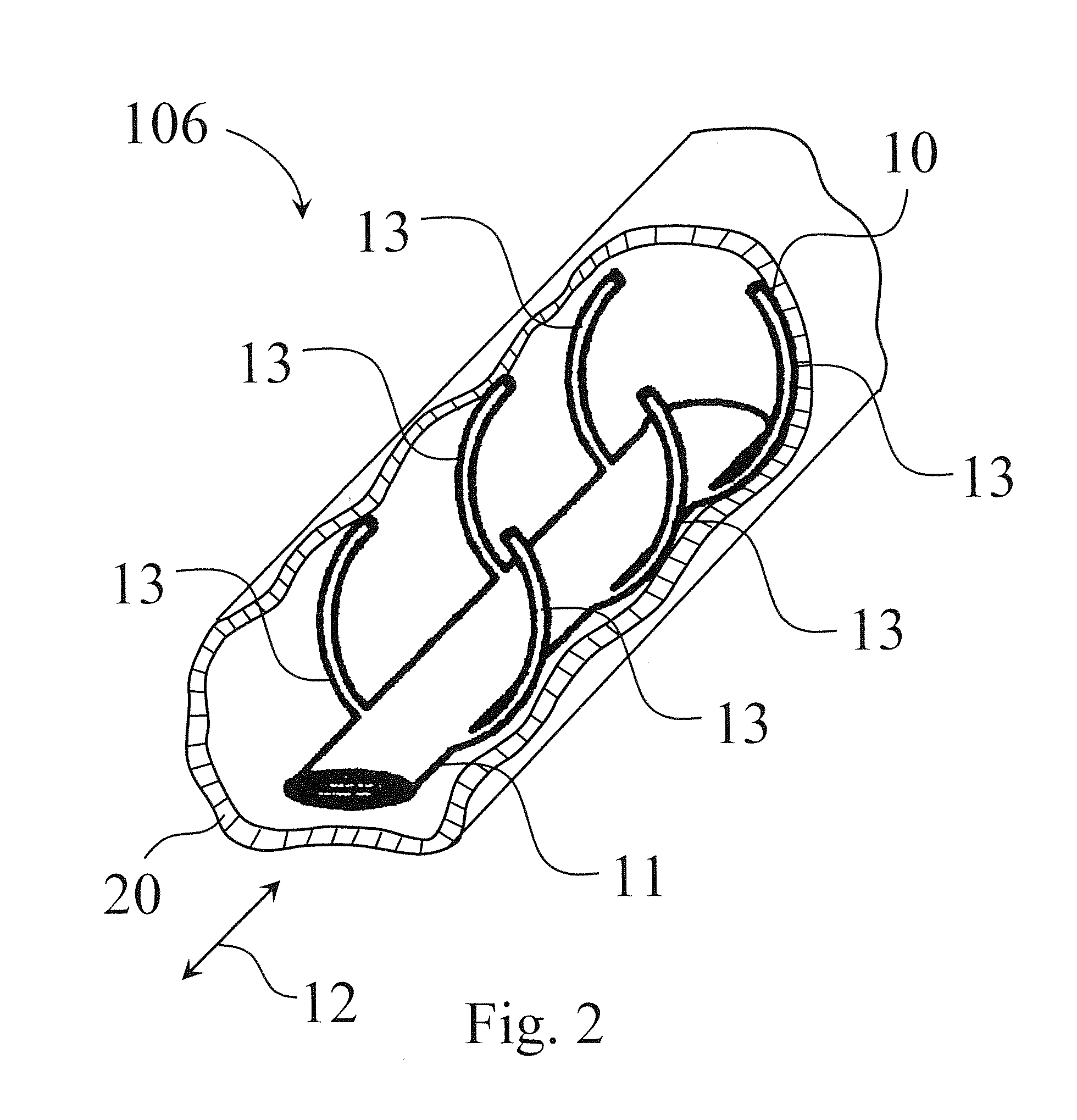 Endovascular electrode system for tissue stimulation