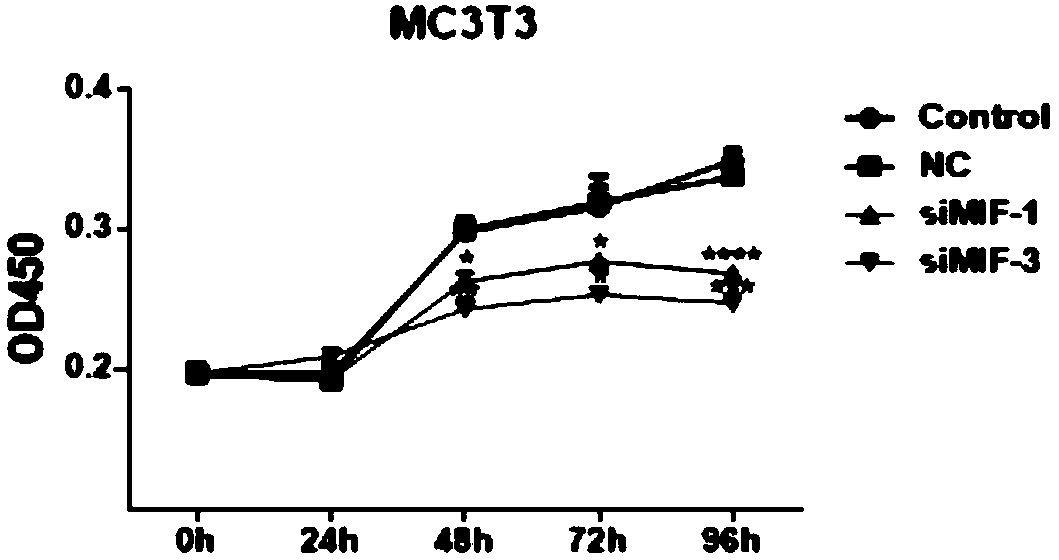 Application of MIF (migratory inhibitory factor) to preparation of product for diagnosing steroid-induced avascular necrosis of femoral head