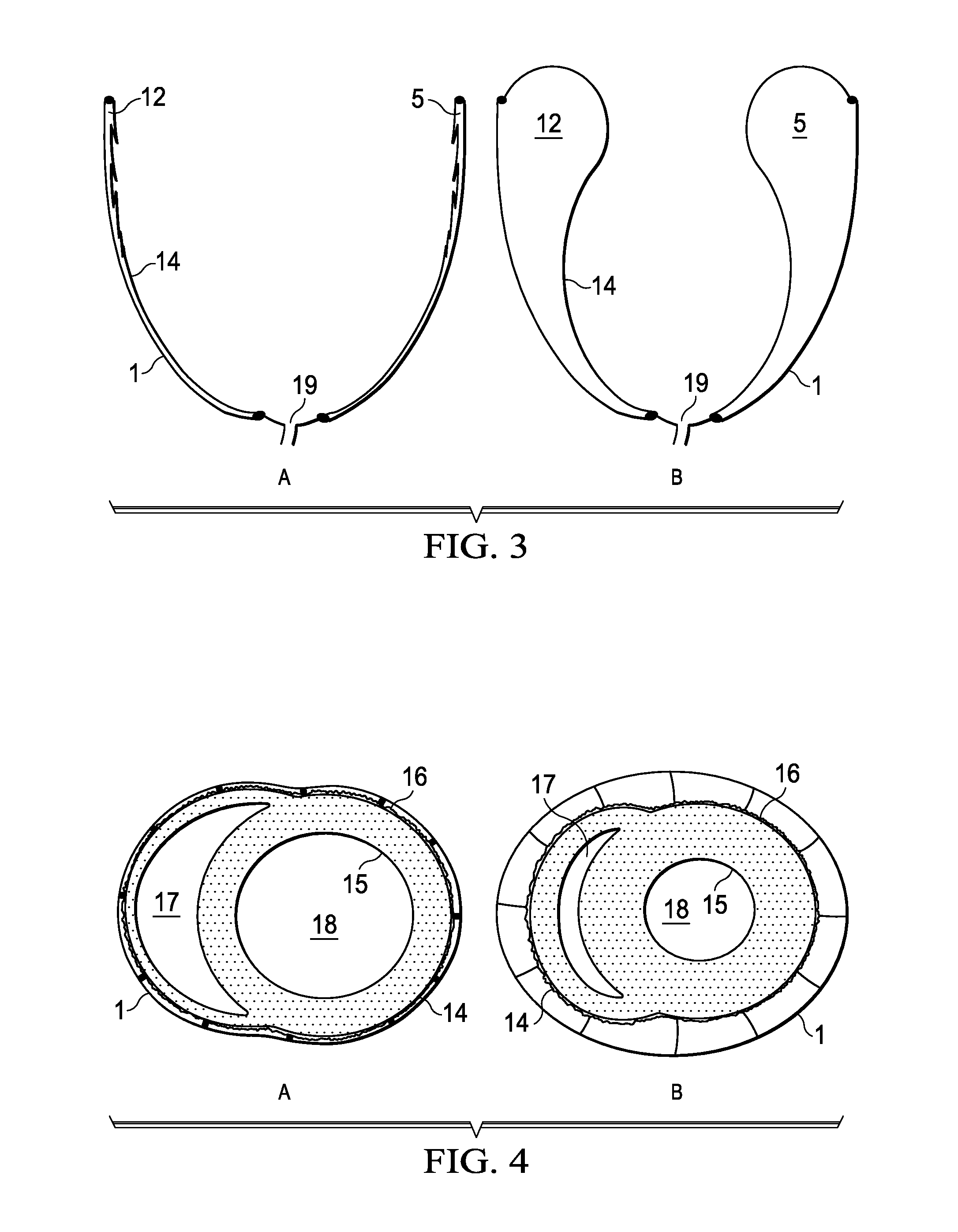 Biphasic and Dynamic Adjustable Support Devices and Methods with Assist and Recoil Capabilities for Treatment of Cardiac Pathologies