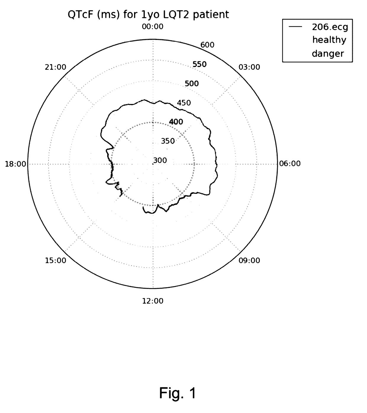 ECG Clock Electrocardiogram Based Diagnostic Device And Method