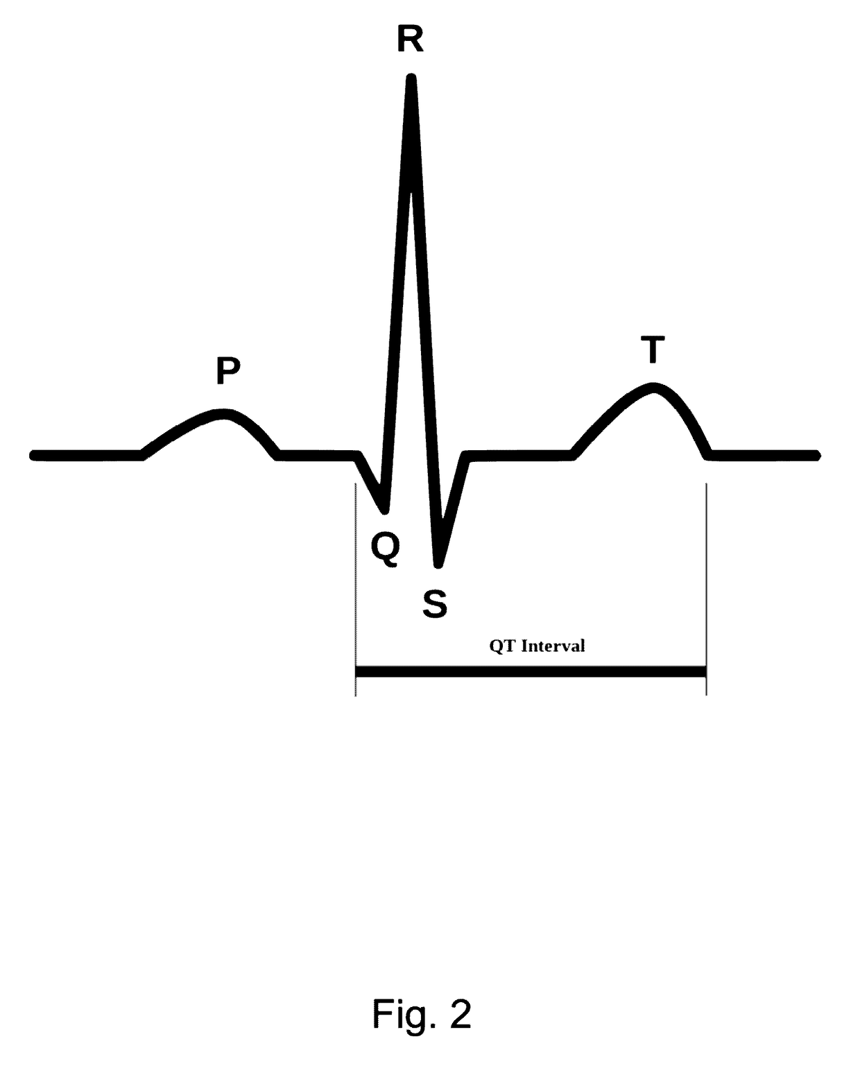 ECG Clock Electrocardiogram Based Diagnostic Device And Method