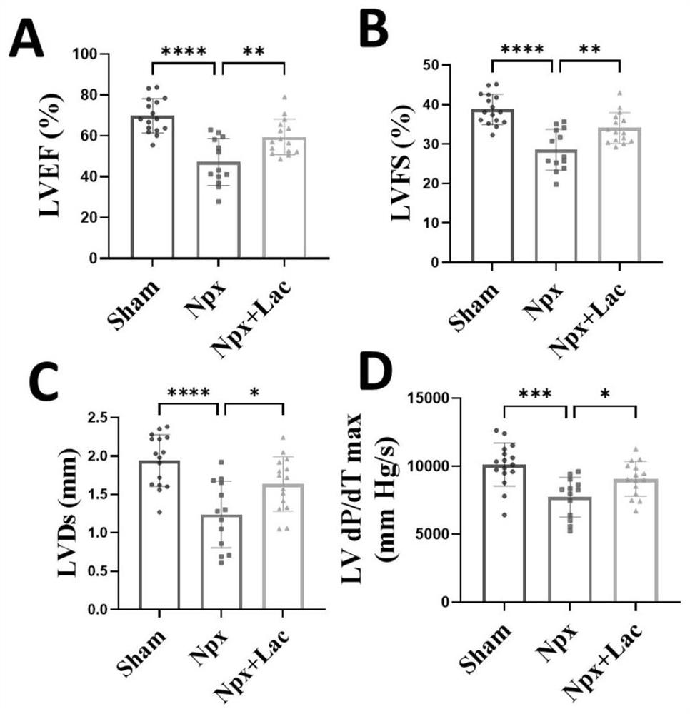 Application of paeoniflorin in preparation of medicine for treating IV-type renal heart syndrome