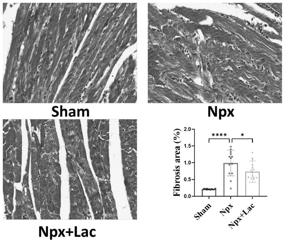 Application of paeoniflorin in preparation of medicine for treating IV-type renal heart syndrome