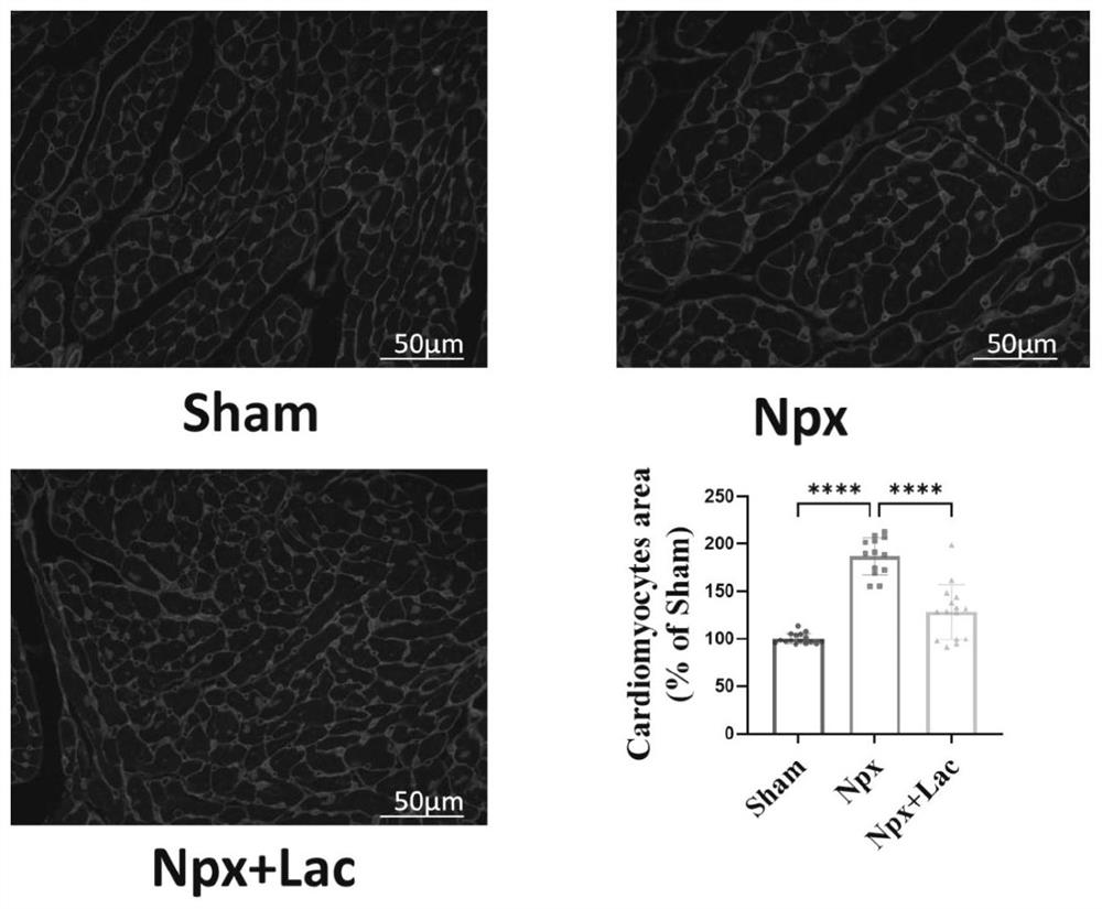 Application of paeoniflorin in preparation of medicine for treating IV-type renal heart syndrome