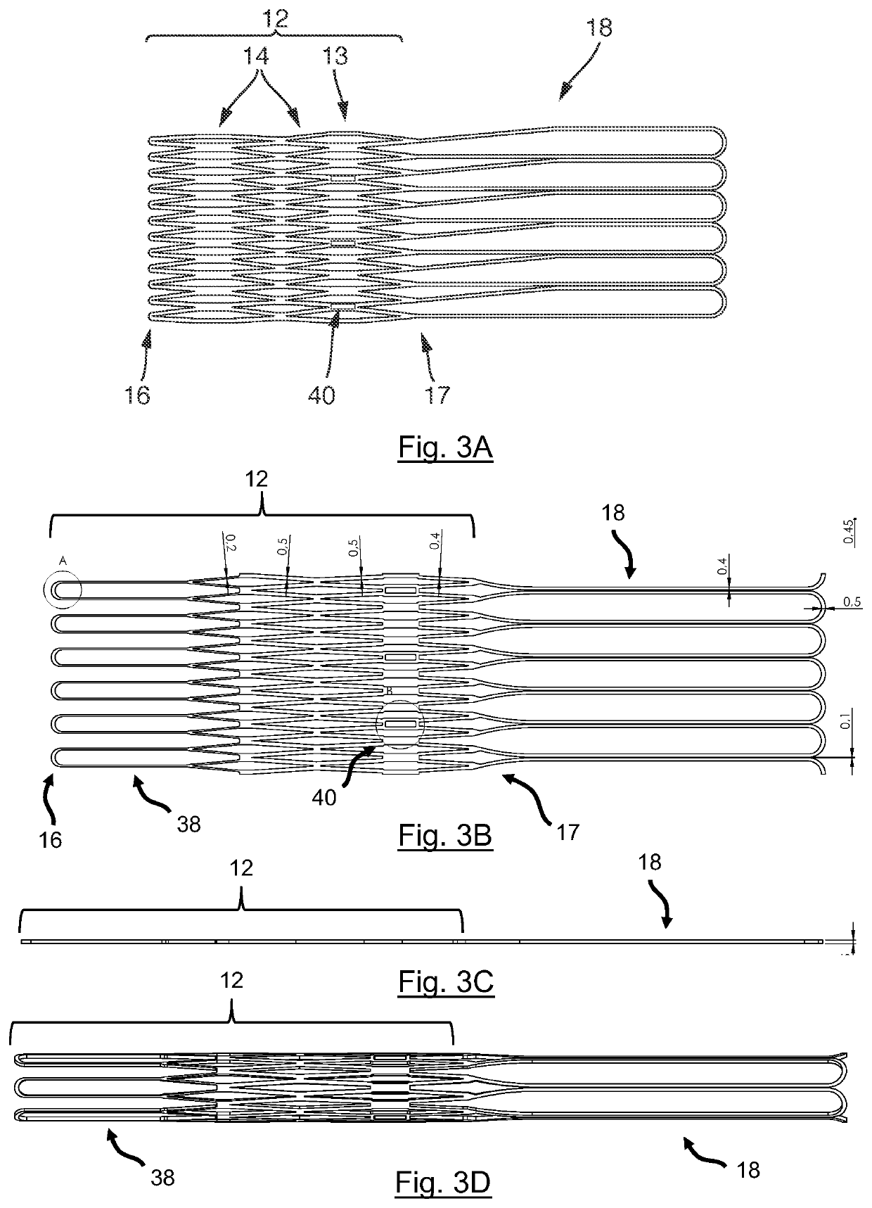 Stent device for a prosthetic heart valve