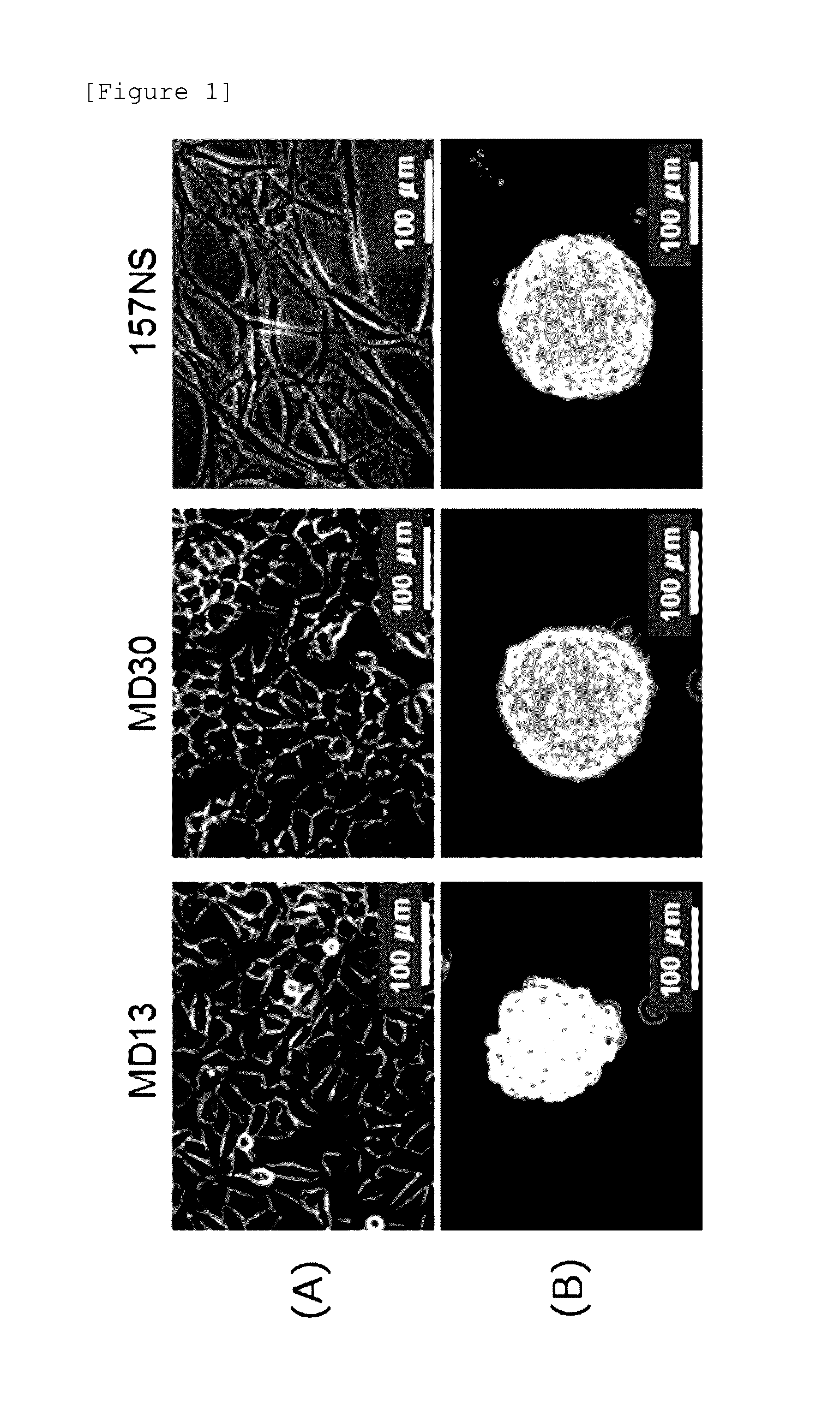 Composition for prevention or treatment of treatment-resistant cancer