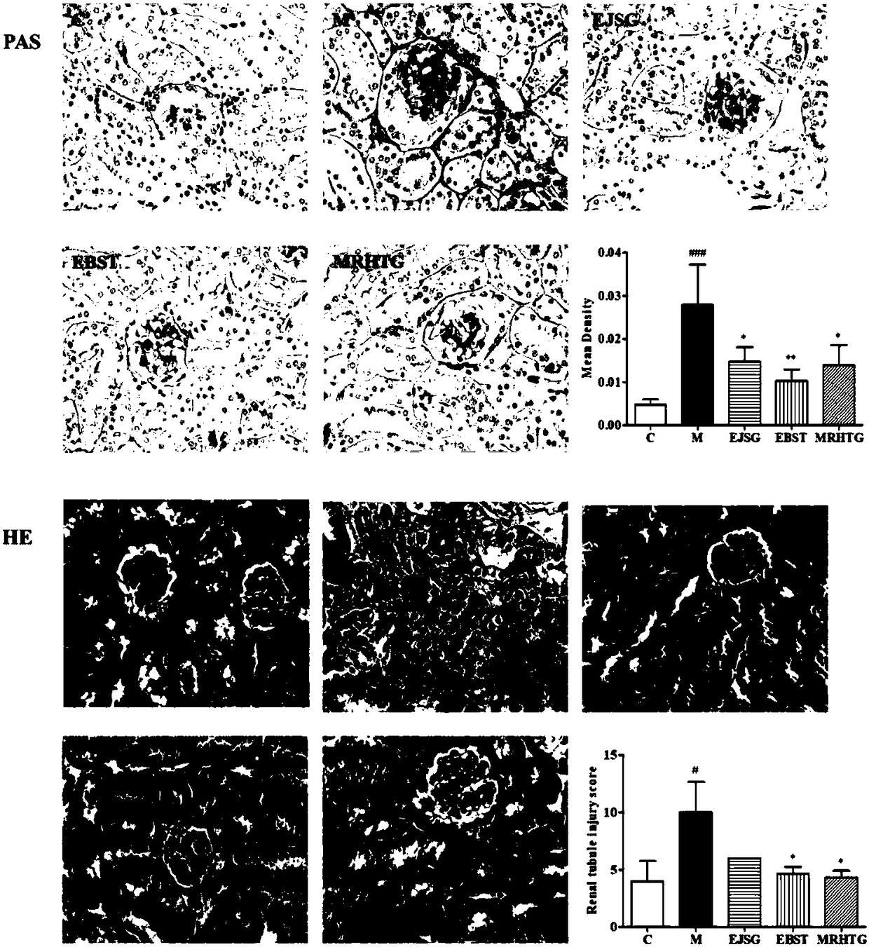 Application of verbascoside in treating and preventing type II diabetic nephropathy