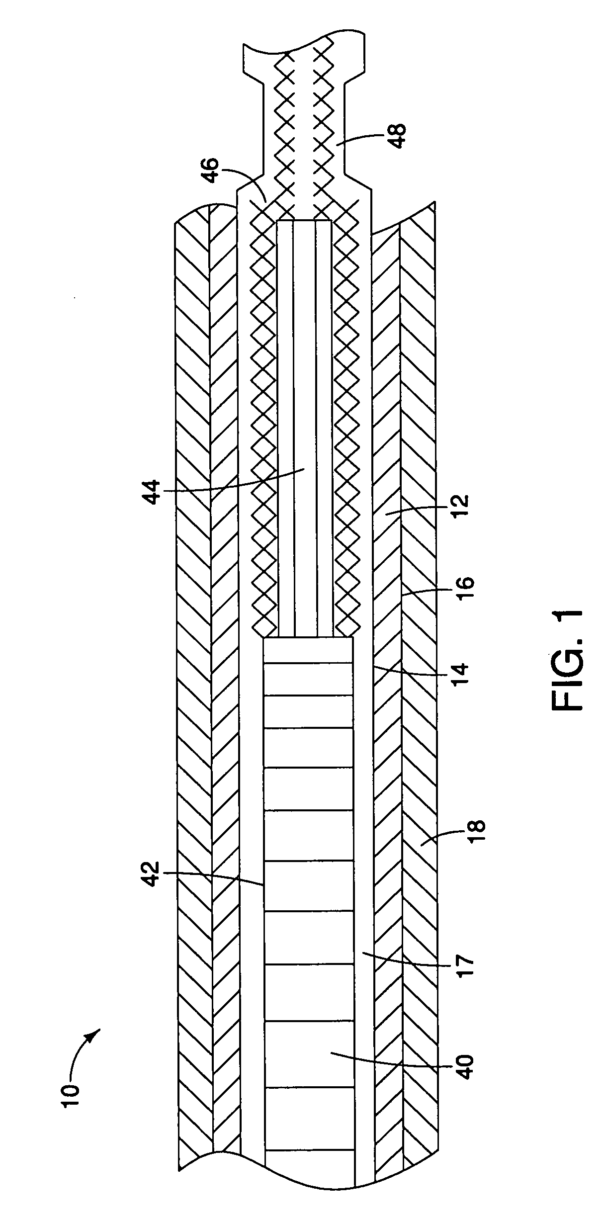 Introducer sheath and method of manufacture