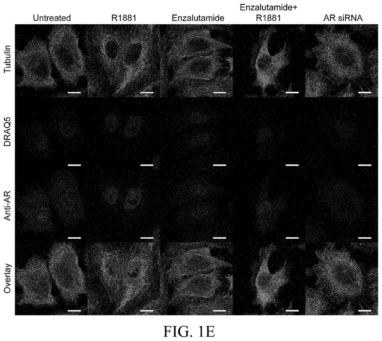 Repurposing Anti-Androgen Therapy for COVID-19 and Immunotherapy