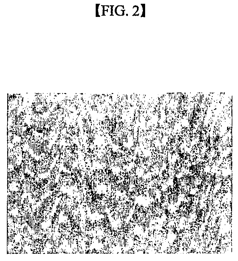 Method for differentiating mesenchymal stem cell into neural cell and pharmaceutical composition containing the neural cell for neurodegenerative disease