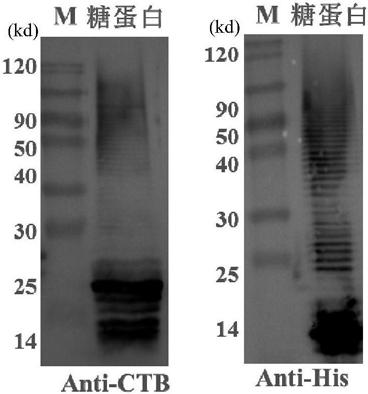 Vaccine for preventing and treating diseases caused by Acinetobacter baumannii and preparation method thereof