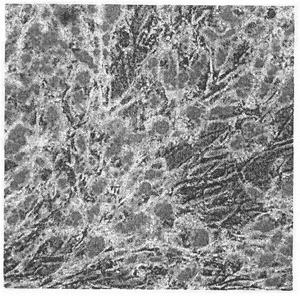 Method for hypoxia culture of endometrial stem cell from menstrual blood