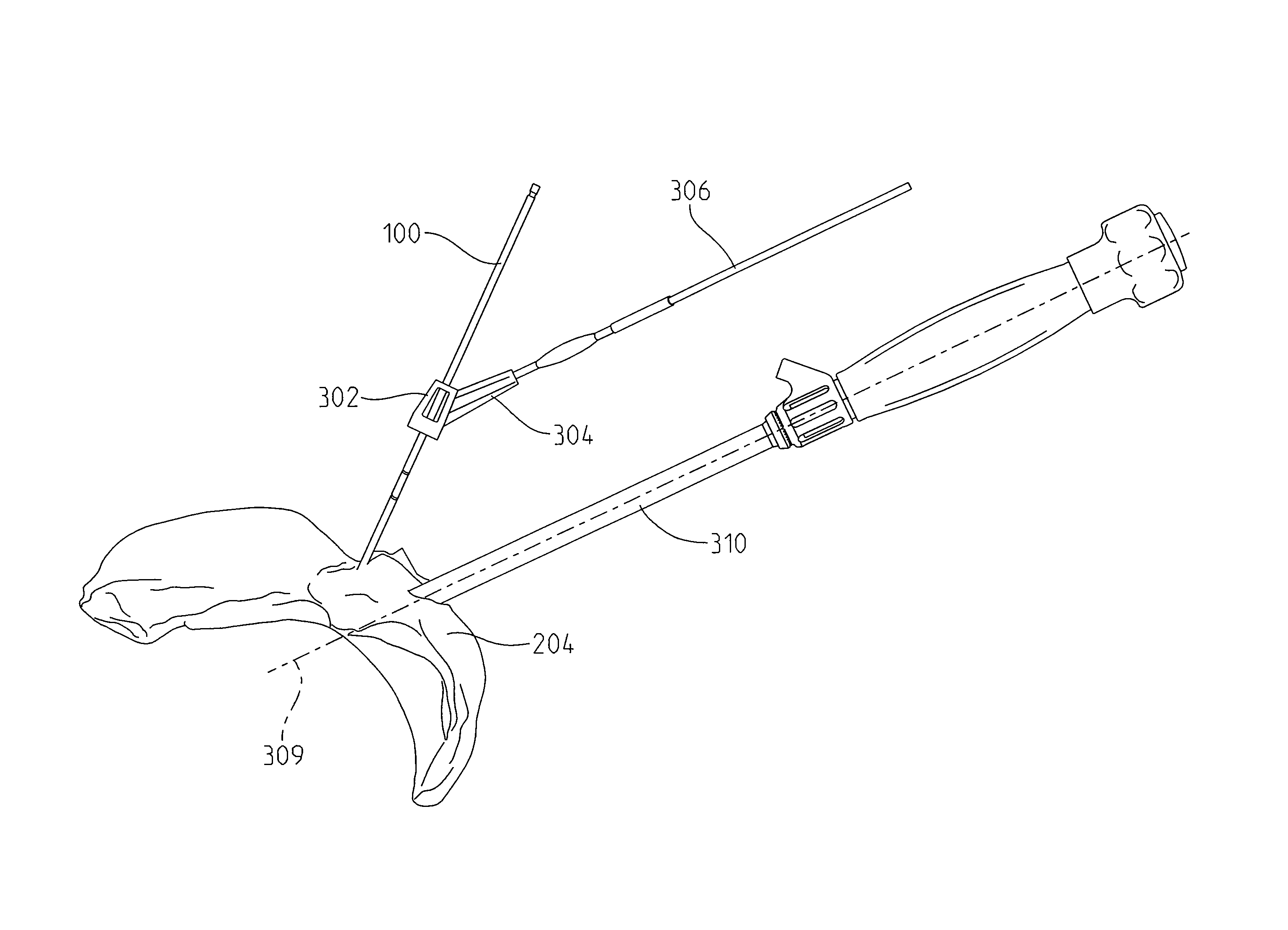 Acetabular drill pin