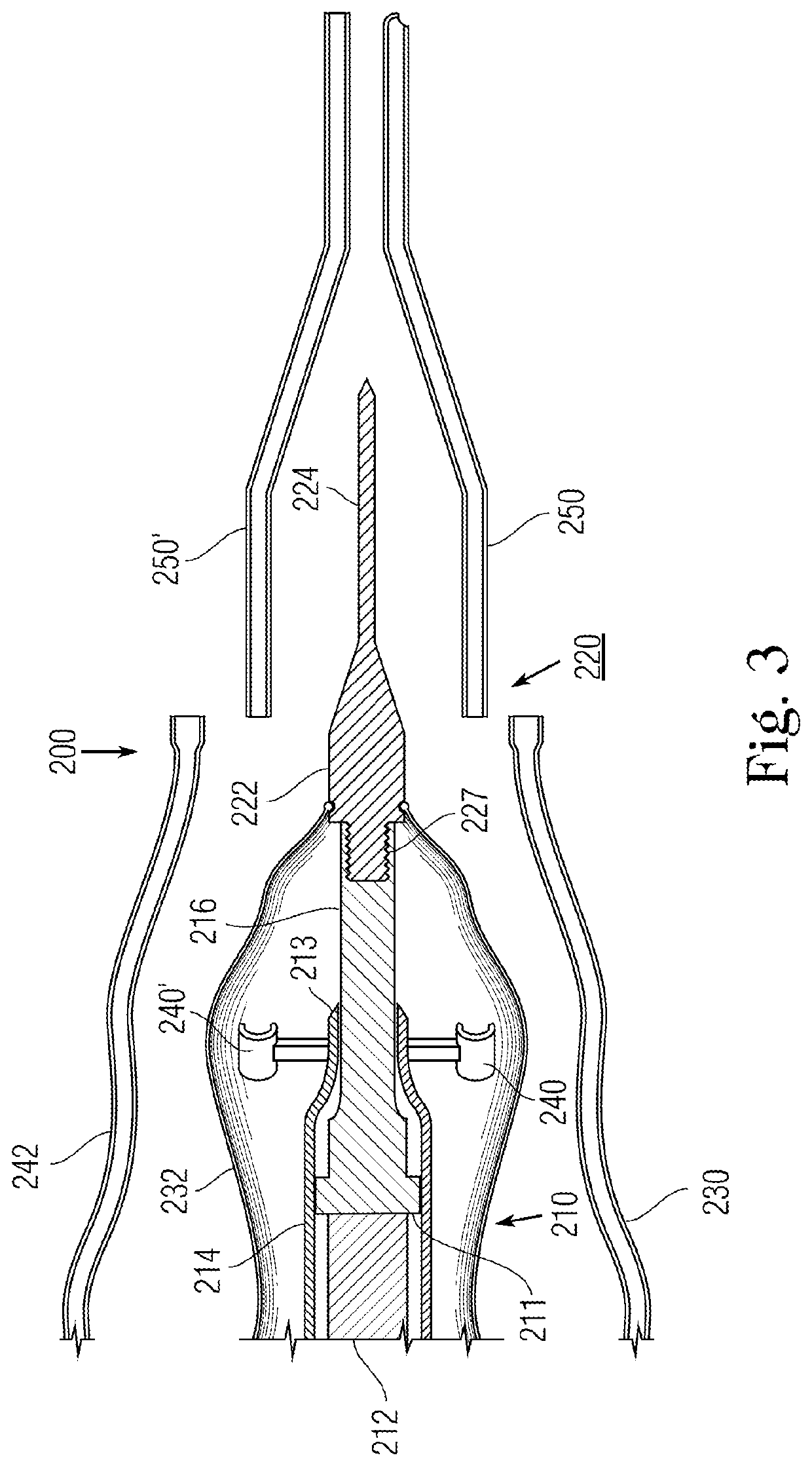 Dual lumen surgical hand-piece with ultrasonic knife