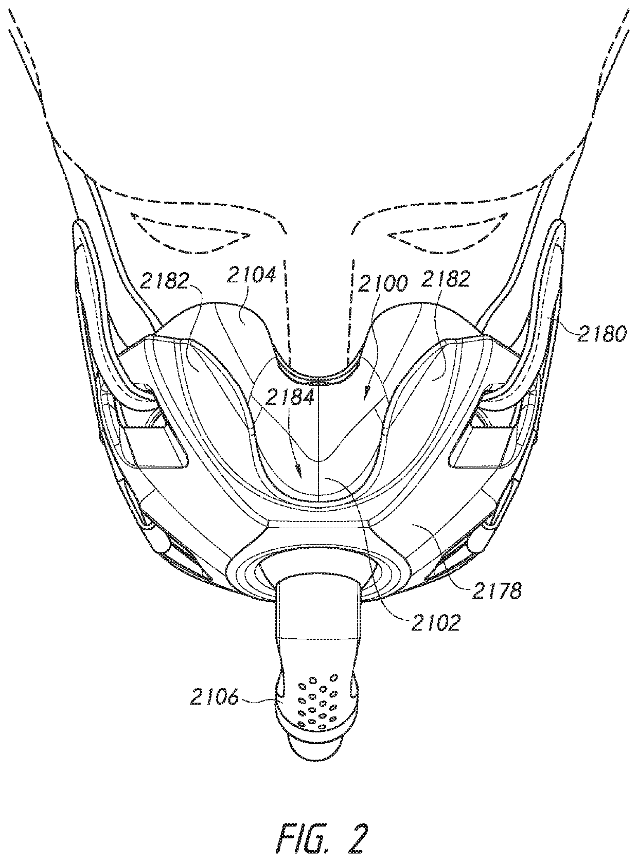 Patient interfaces