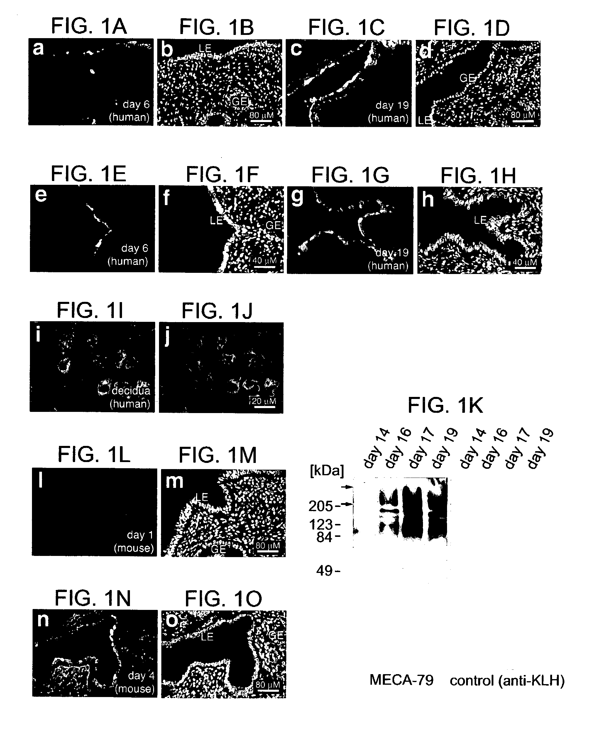 Method of determining endometrial receptivity