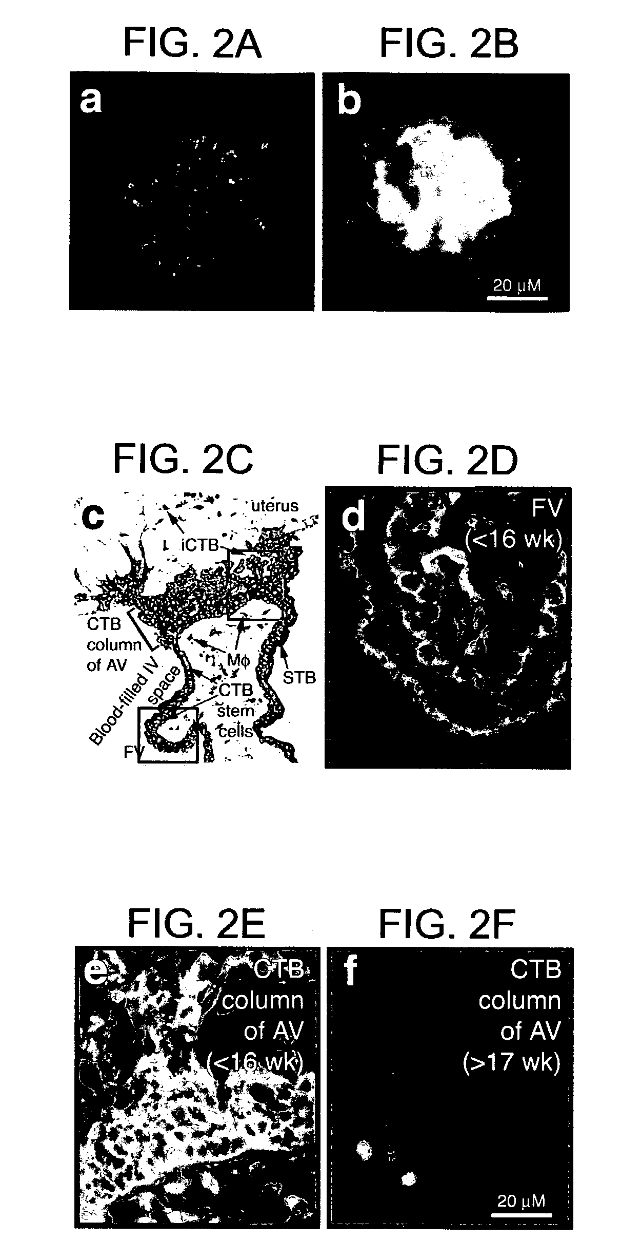 Method of determining endometrial receptivity