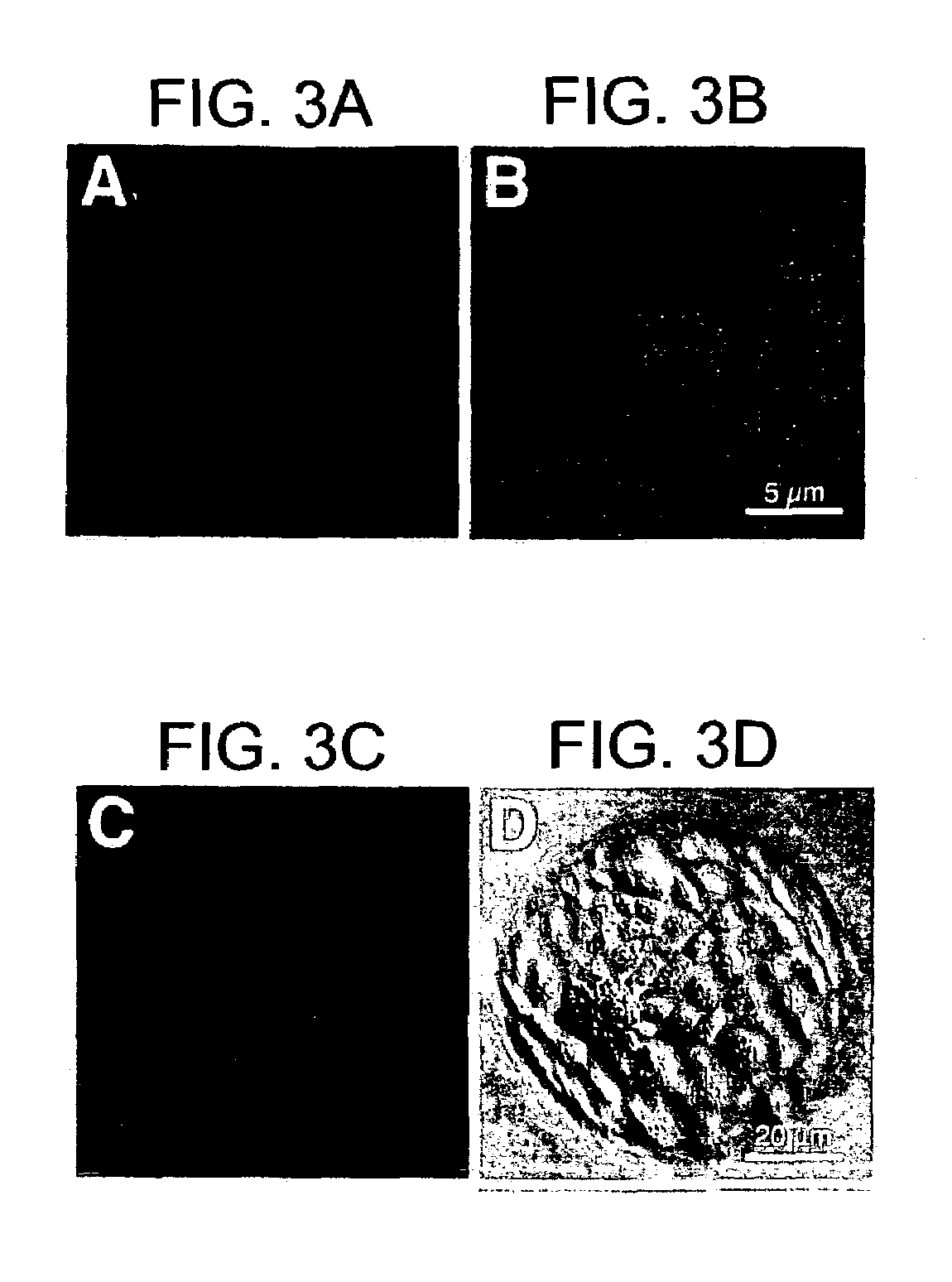 Method of determining endometrial receptivity