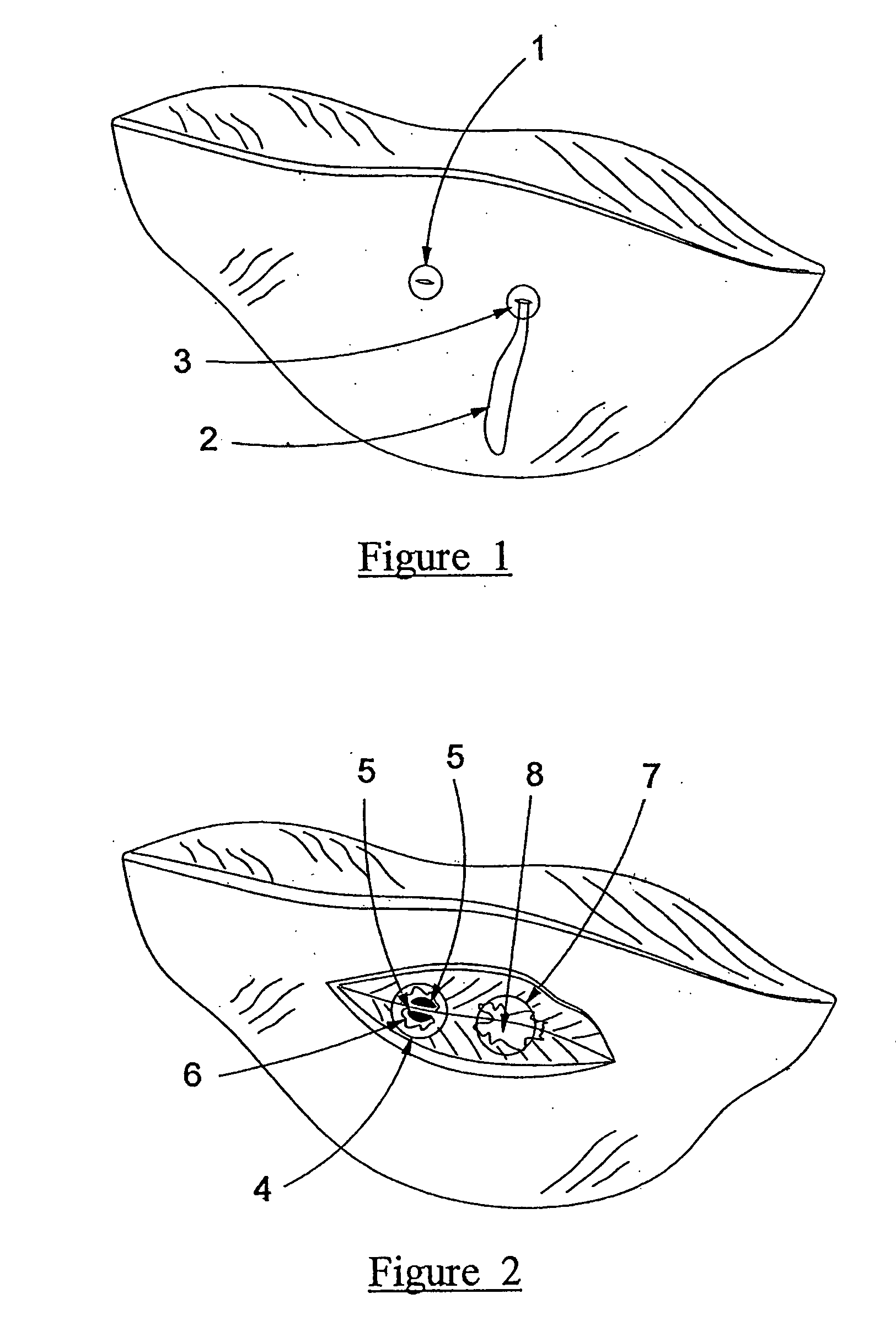 Injection formulation