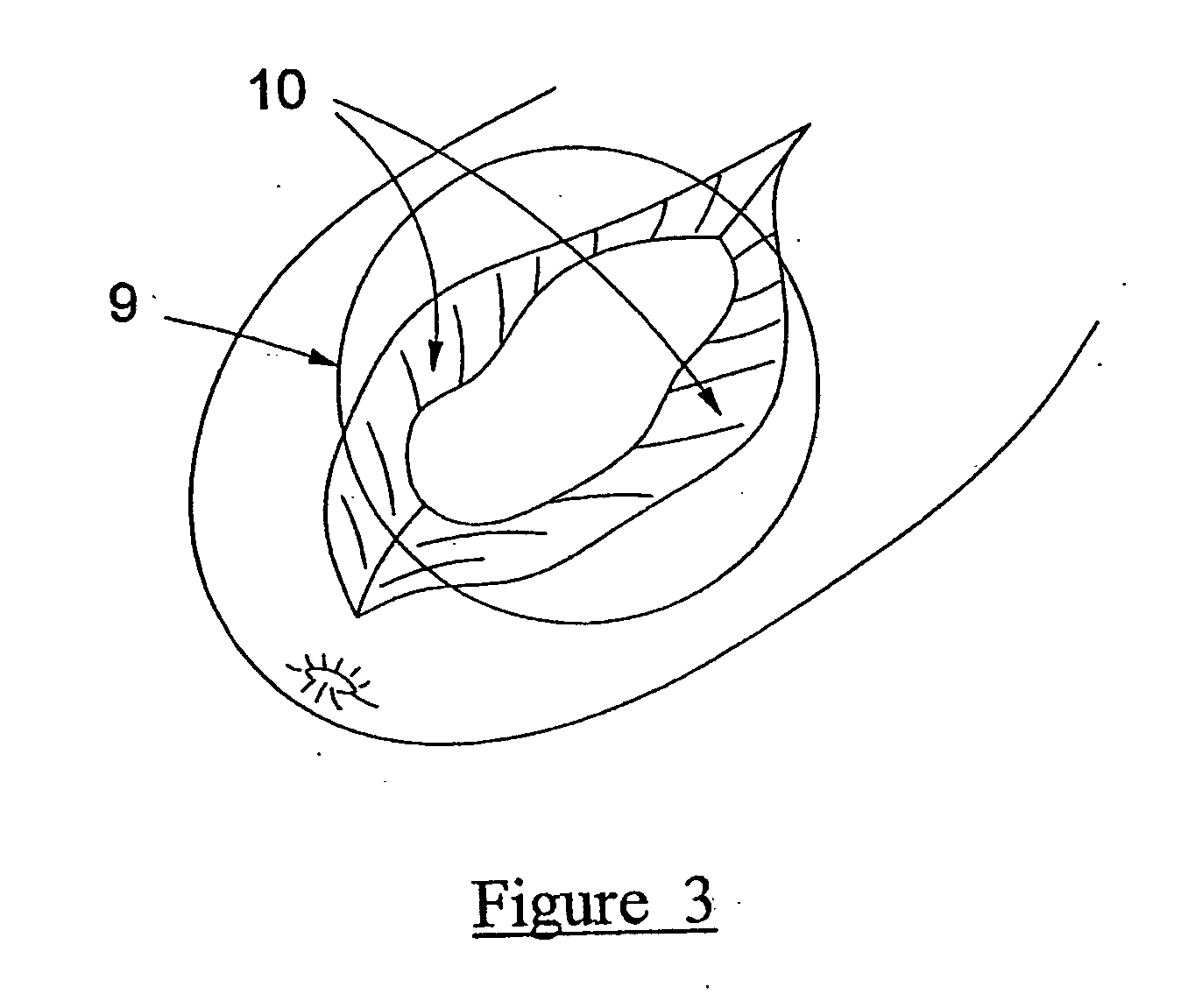 Injection formulation