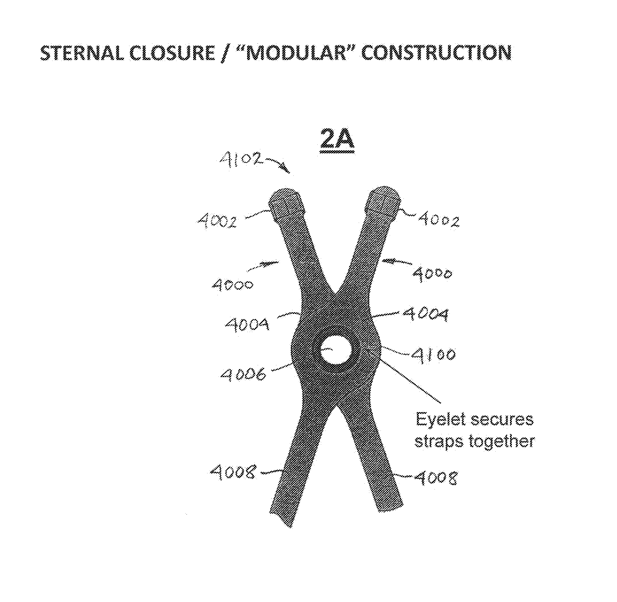 Systems and methods for sternum repair