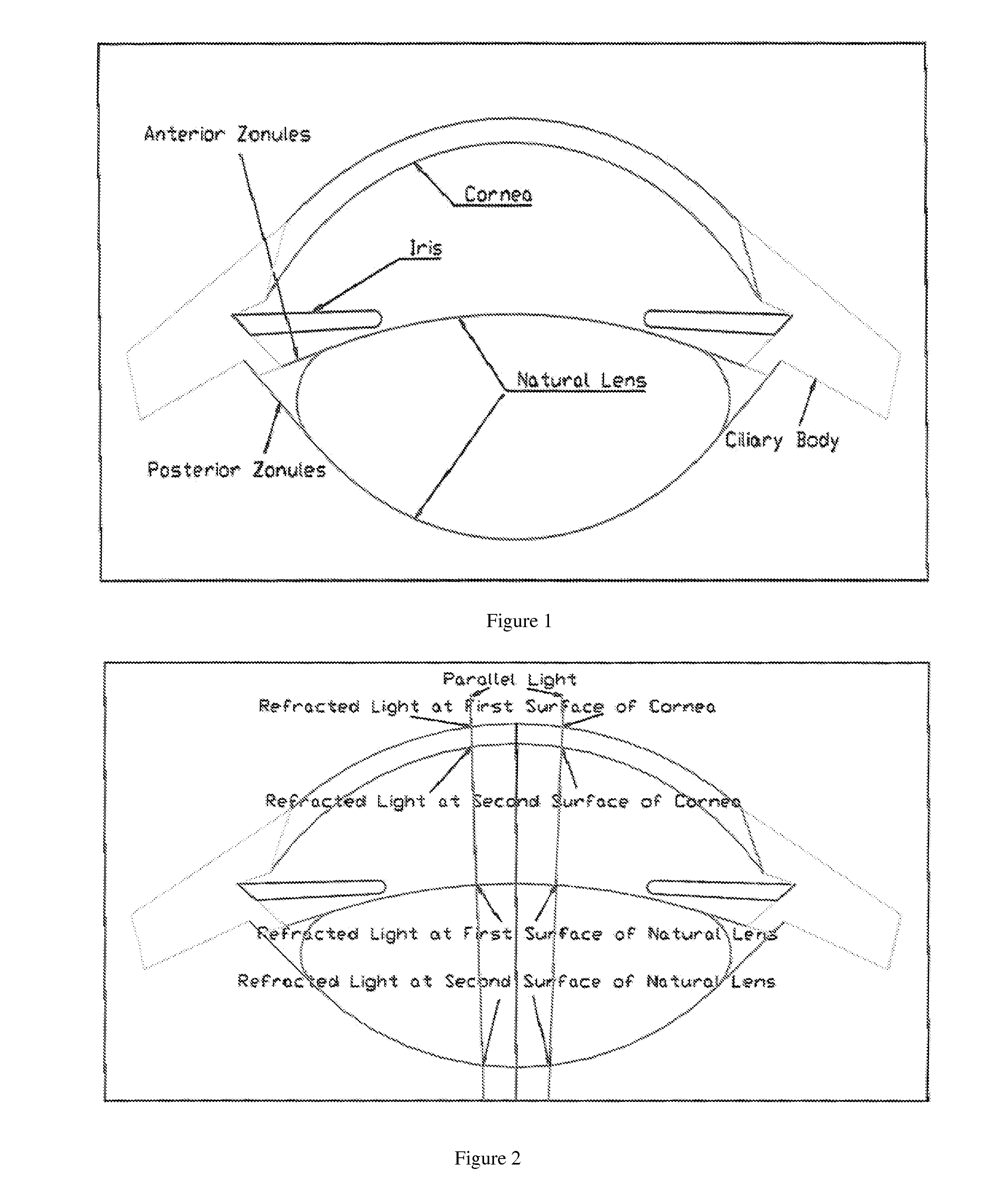 Model of accommodative intraocular lens