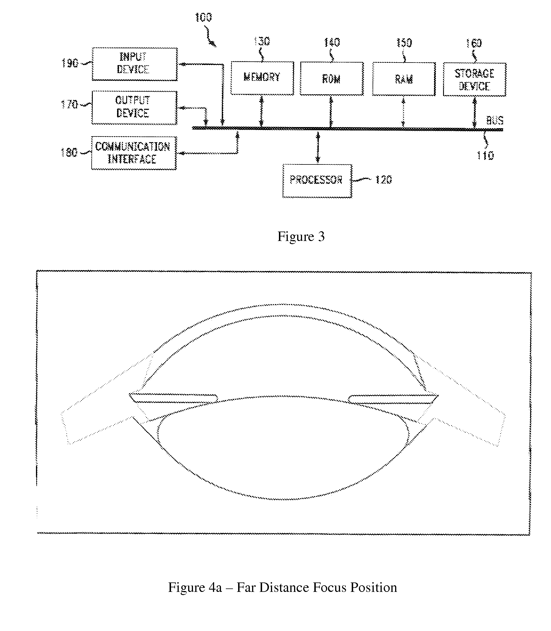 Model of accommodative intraocular lens